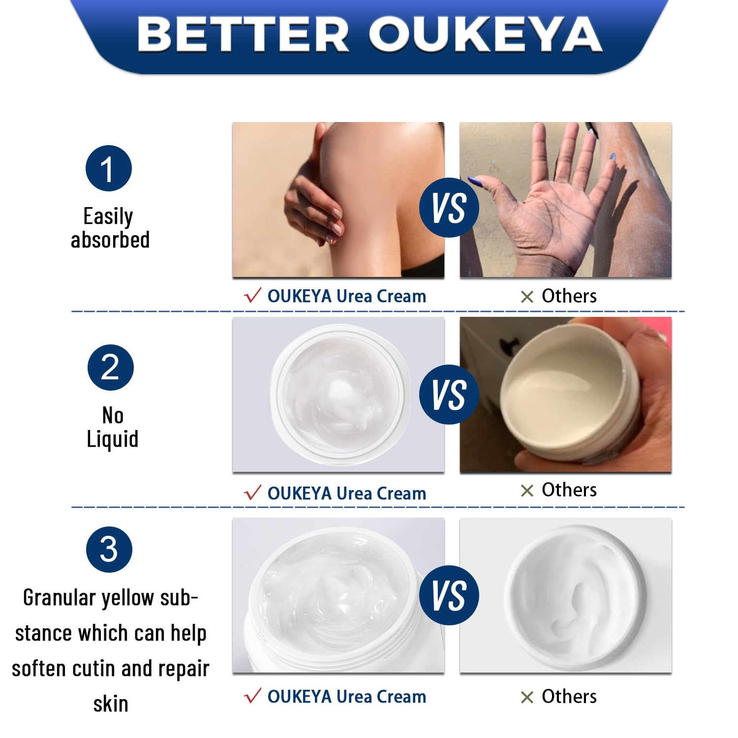 OUKEYA Urea Cream 42% plus Salicylic Acid 2% Net 350g for Dry Cracked Feet, Heels, Knees, Elbows, Hands Repair Treatment.Moisturizes and Removes Corns,Calluses,Dead Skin,and Softens Toenails - Image 6