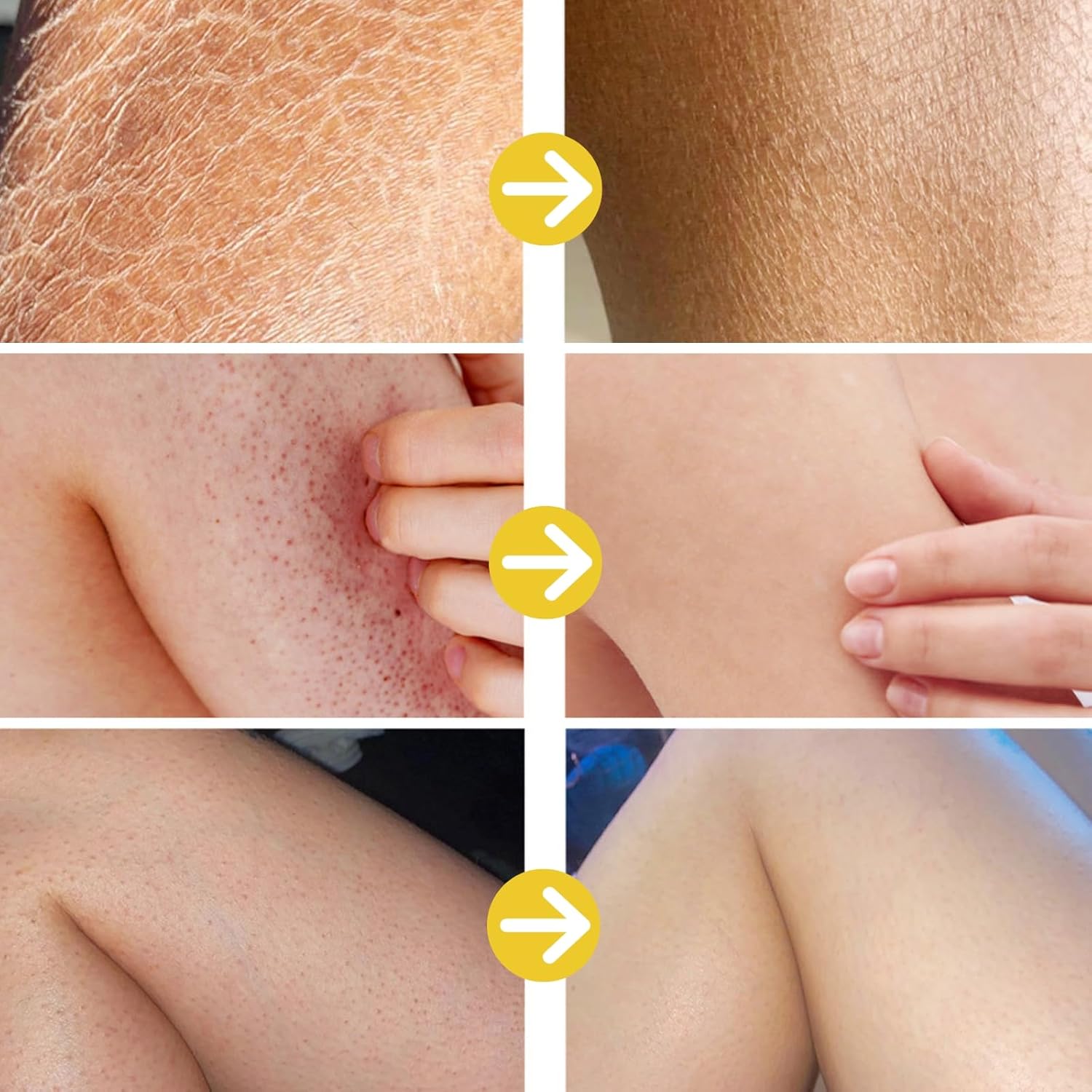 Strawberry Legs Treatment For Women - Kera-tosis Pil-aris Treatment Lotion for Dry Skin - Strawberry Skin Trea-tment Body Moisturizer - Rough and Bumpy Skin Lotion - Straw berry S kin Remover - Image 6