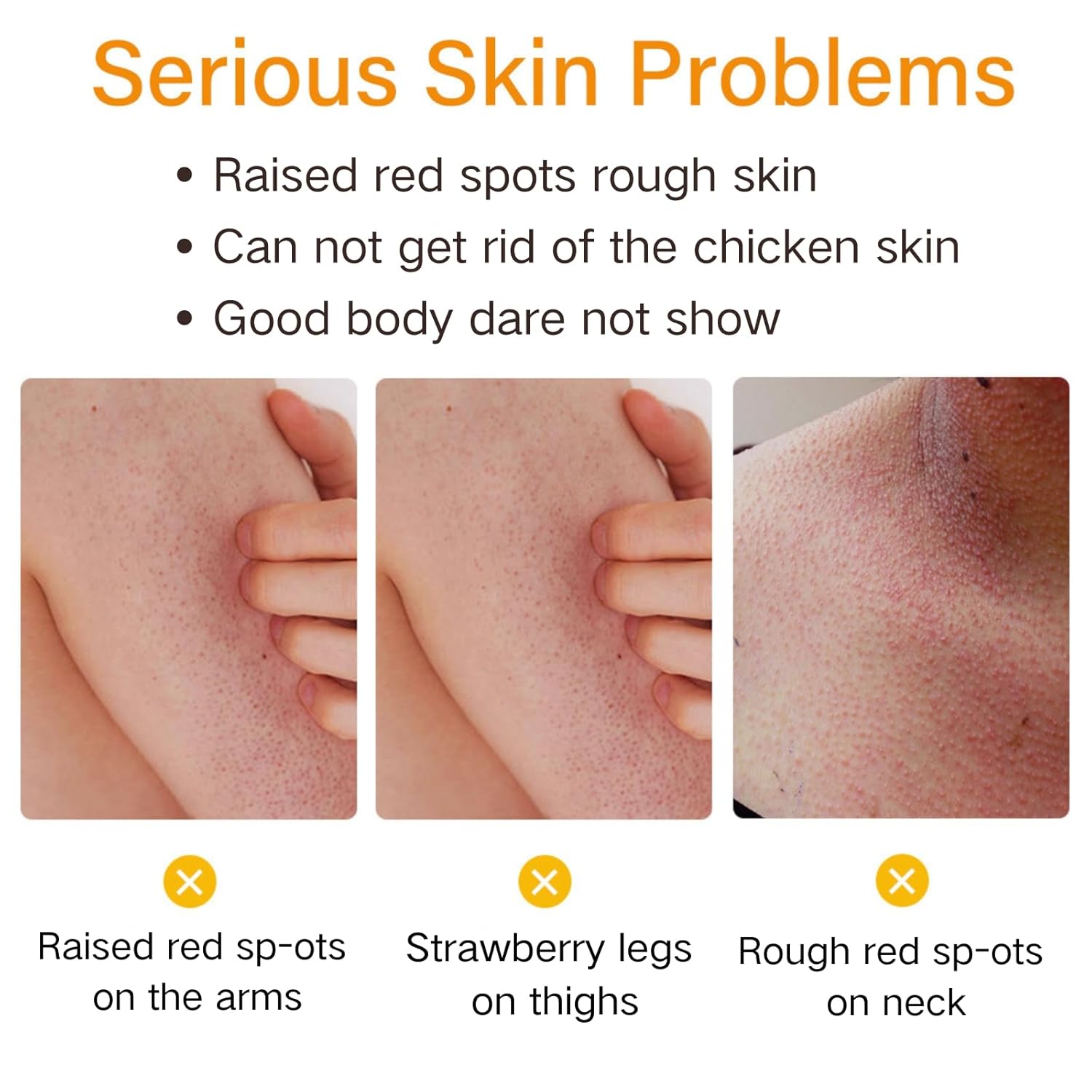 Strawberry Legs Treatment For Women - Kera-tosis Pil-aris Treatment Lotion for Dry Skin - Strawberry Skin Trea-tment Body Moisturizer - Rough and Bumpy Skin Lotion - Straw berry S kin Remover - Image 5