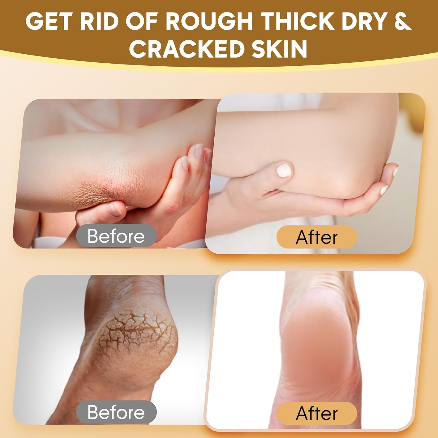 Urea Cream 50 Percent for Feet Maximum Strength with Oat and 2% Salicylic Acid, Foot Cream for Dry Cracked Heels and Feet, 8.8 oz - Image 4