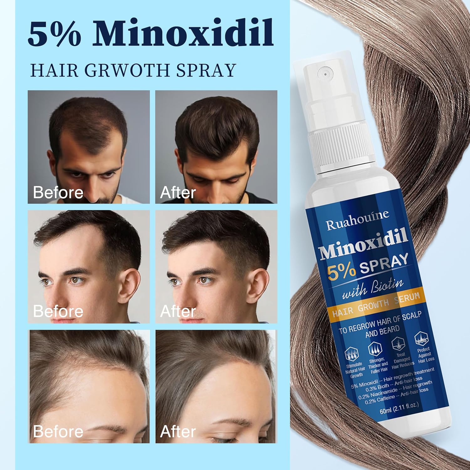 5% Minoxidil Hair Growth Spray with Brush for Women & Men, Minoxidil Biotin for Men Beard, 60ml / 2.11 fl.oz - Image 4