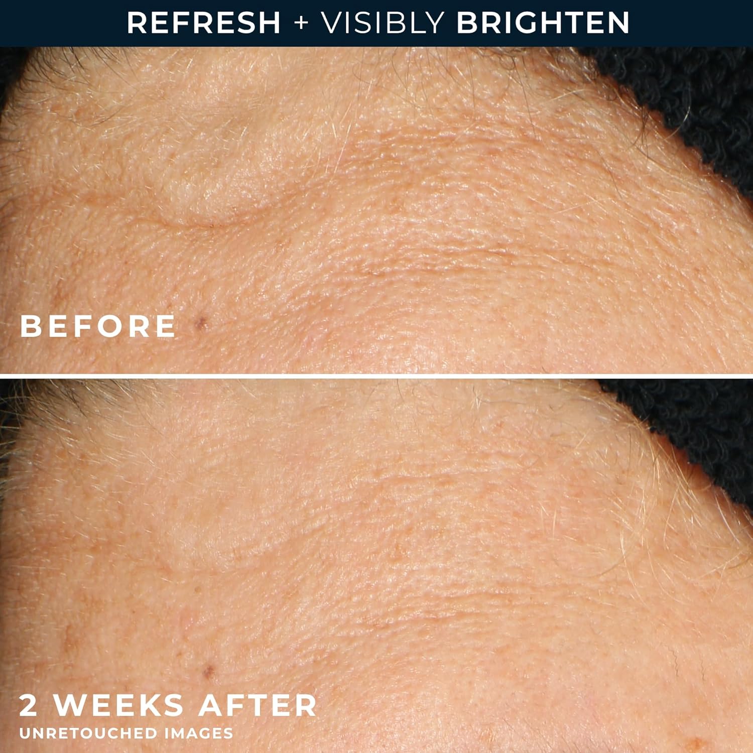 RoC Multi Correxion Revive + Glow Gel Cleanser Vitamin C Glycolic Acid Paraben Free 6 oz - Image 5