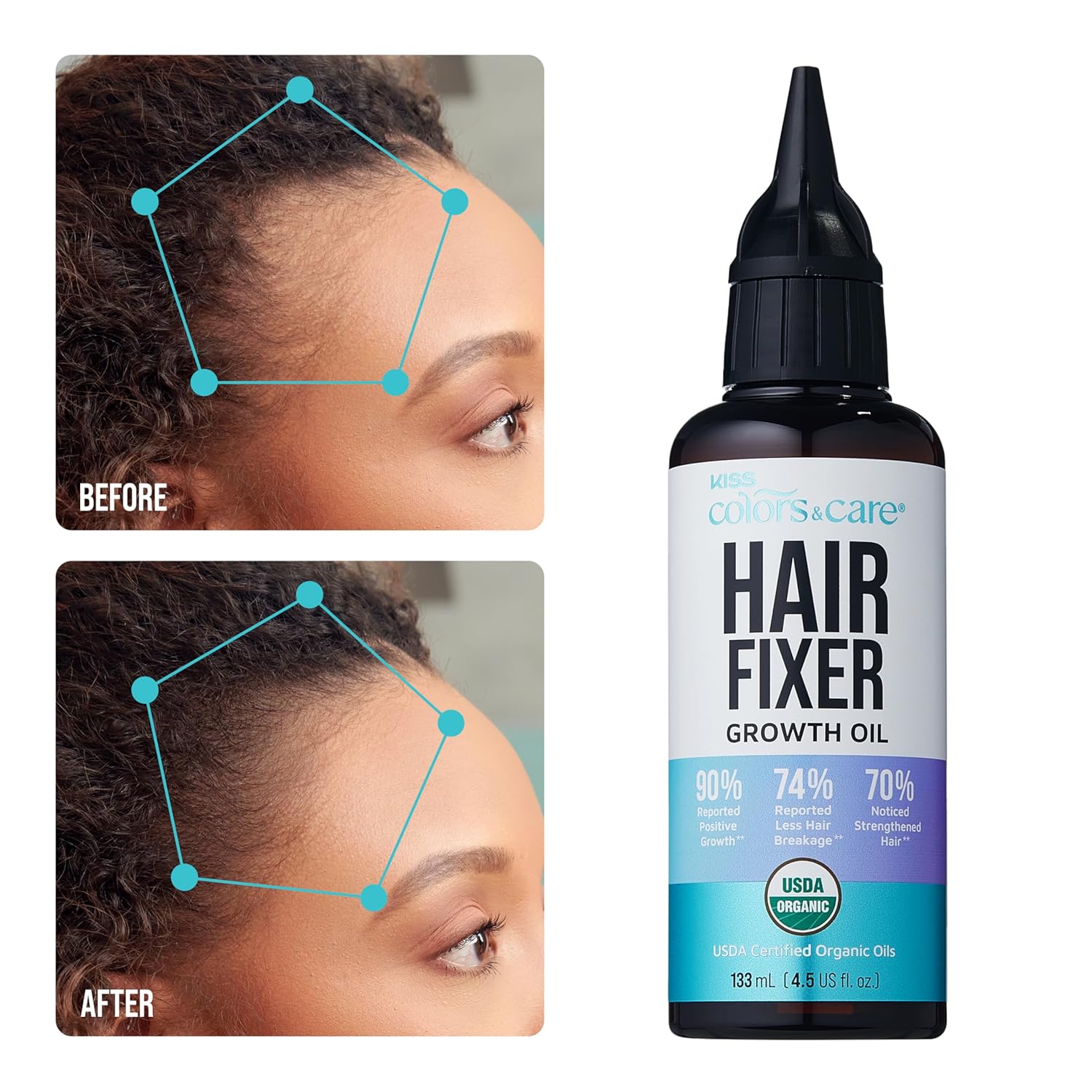 KISS Colors & Care Organic Hair Fixer Growth Oil 133mL for Stronger Follicles Reduced Breakage - Image 6