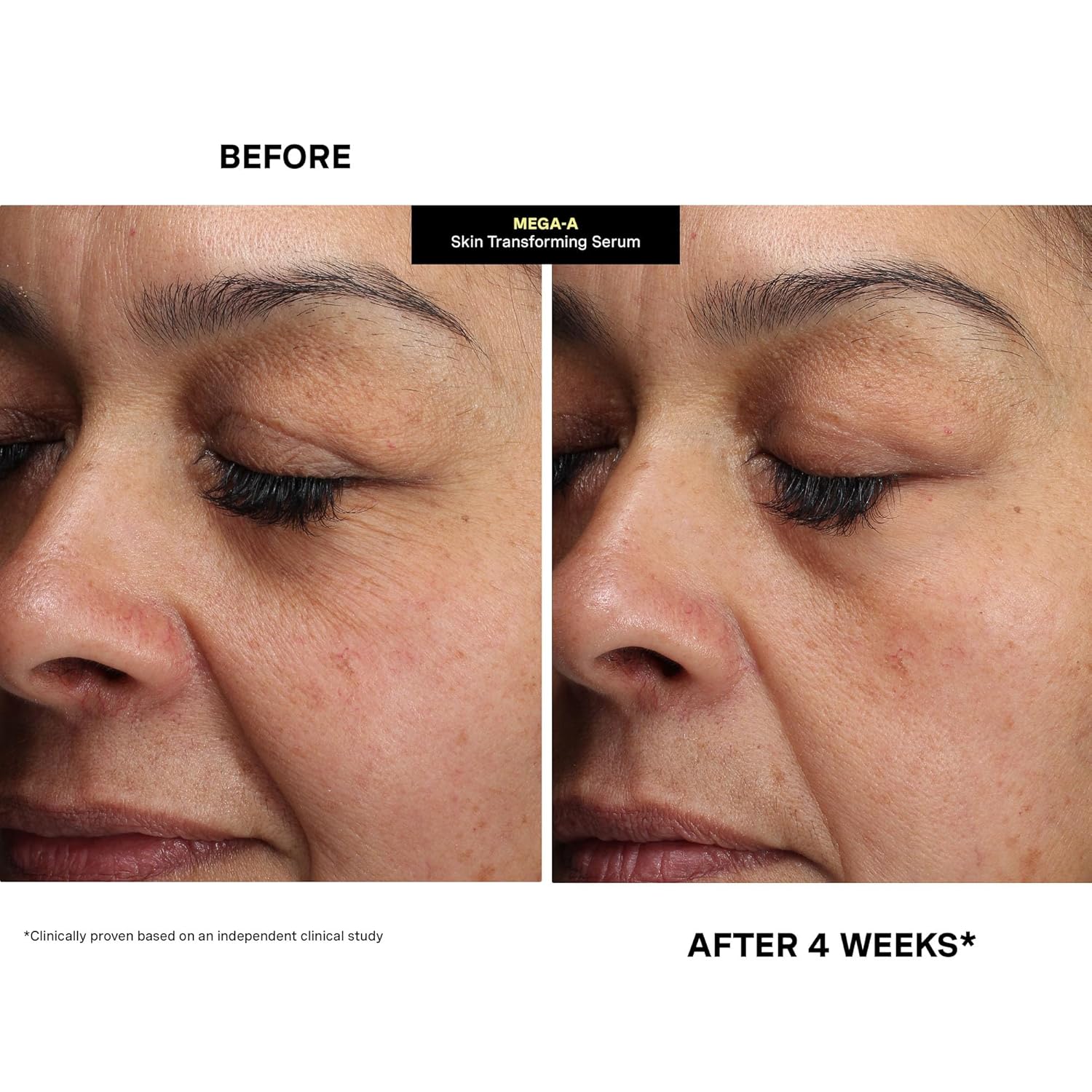 Kate Somerville Mega-A Skin Transforming, Anti-Aging Serum with Hyaluronic Acid For Uneven Texture and Wrinkles, 1 Fl. Oz - Image 8