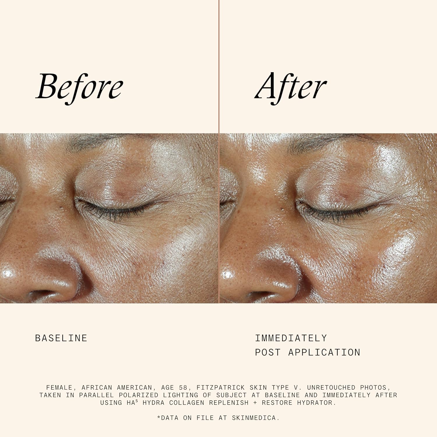 SkinMedica HA5 Hydra Collagen Replenish + Restore Hydrator – Next-Gen HA5 With 2X More Hyaluronic Acid. Enhanced for Instant Hydration & Smoothness to Restore Skin’s Hydration Reservoir, 2 Oz - Image 3
