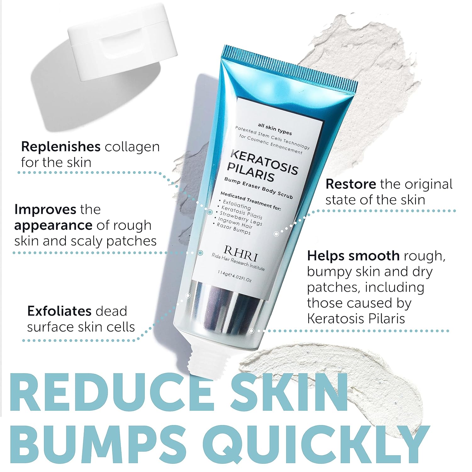 KP Bump Eraser Exfoliating Body Scrub for Keratosis Pilaris Smooth Skin 8 oz - Image 2