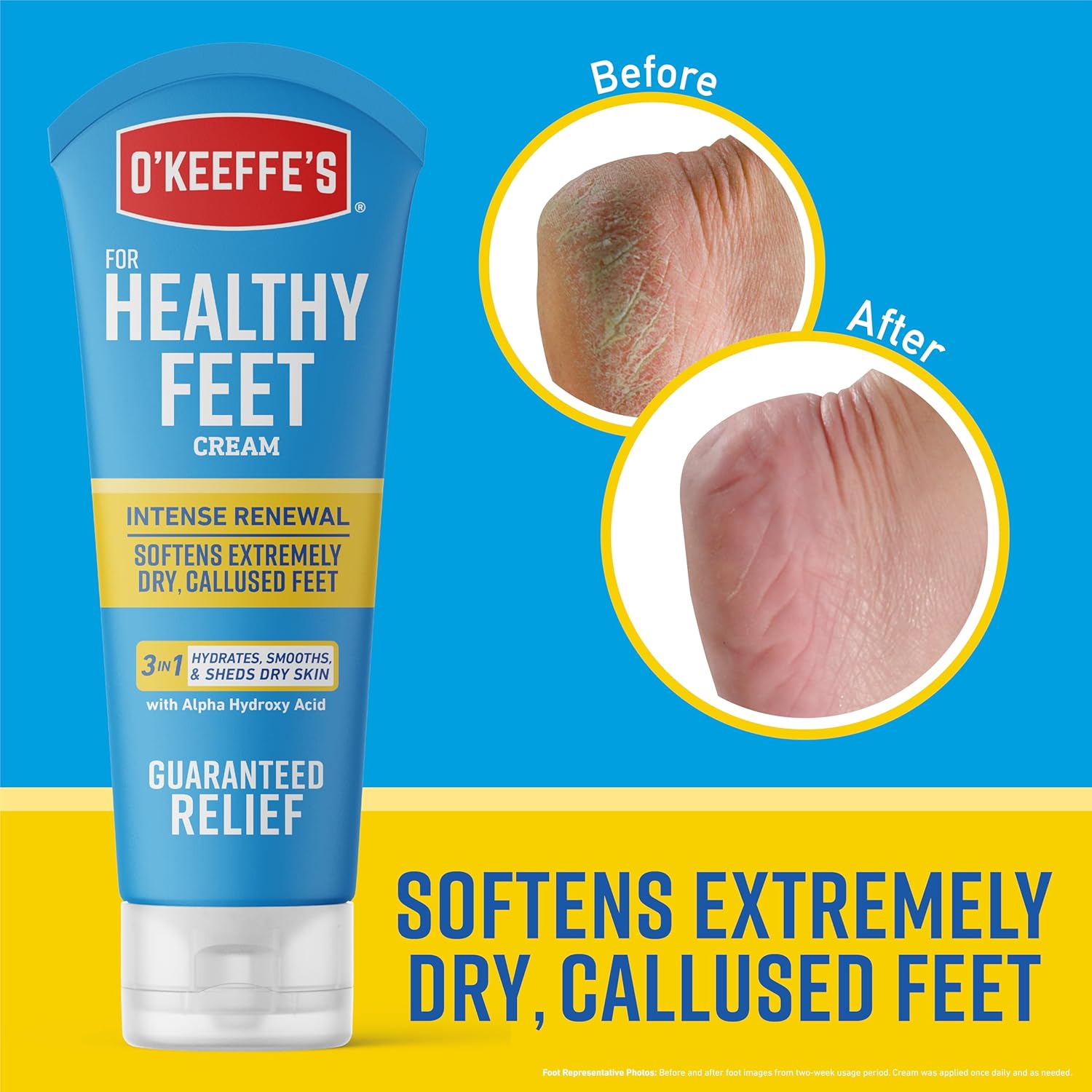 O'Keeffe's for Healthy Feet Intense Renewal Cream with Urea & Alpha Hydroxy Acid - 3 oz Tube (1 Pack) - Softens and Chemically Exfoliates Extremely Callused, Dry Feet - Image 3