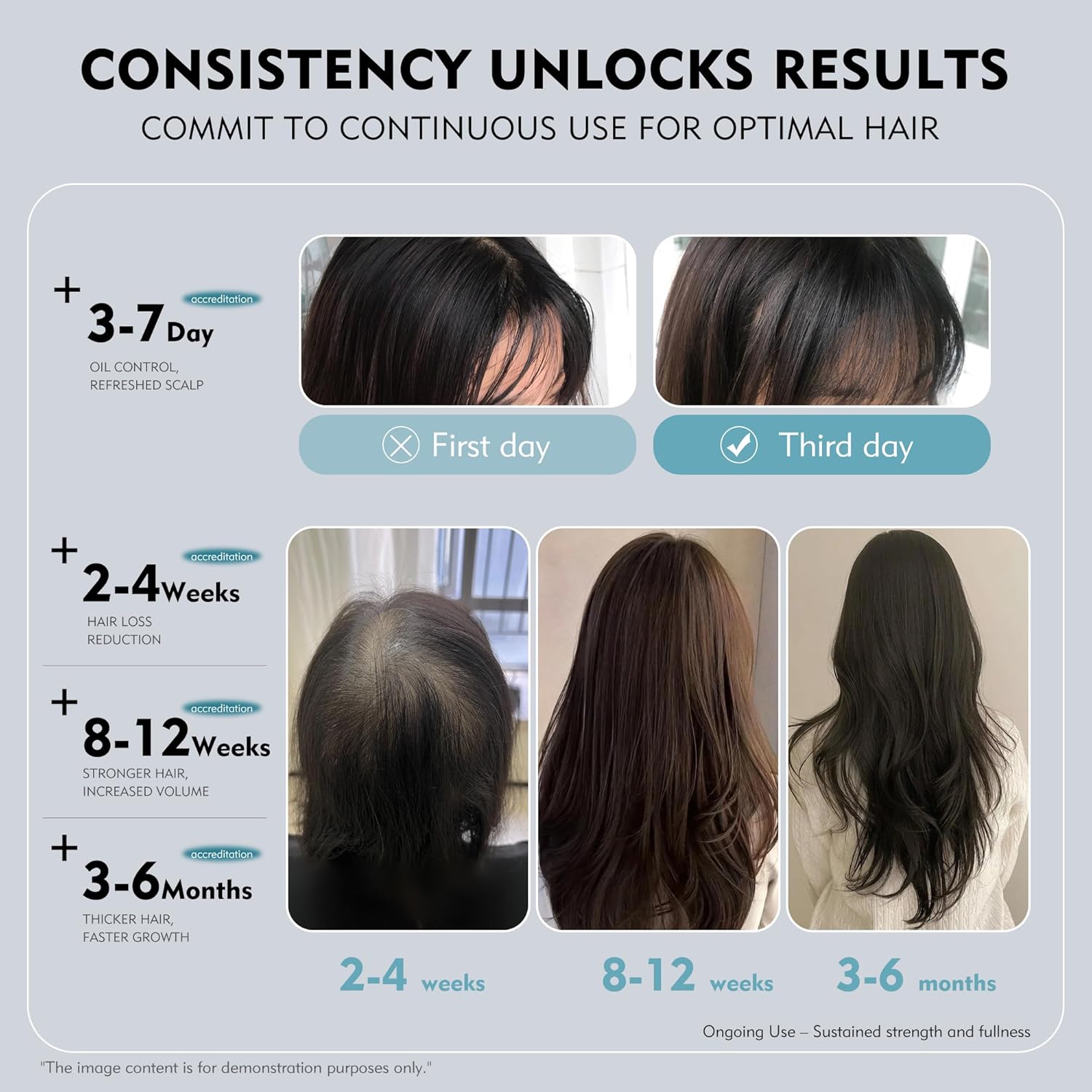 0.5% KX-826 DHT Blocker Hair Regrowth Treatments,3 Days Oil Control 1-2 Weeks Hair Loss Reduction 4-6 Weeks New Hair Visible,Hair Growth Spray Growth Products for Men&Women -1 Month Supply 60ml - Image 4