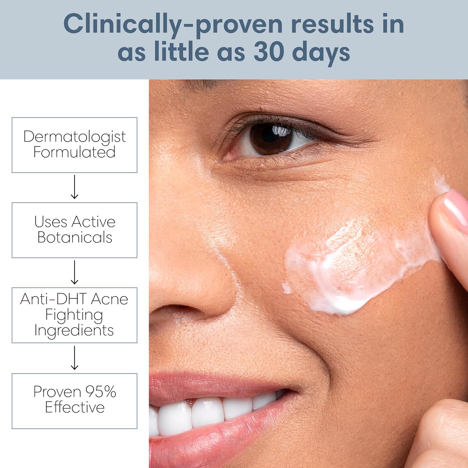 Sensitive Skin Sulfur Acne Lotion Treatment Cream 1.8 Fl Oz Ointment - Image 2