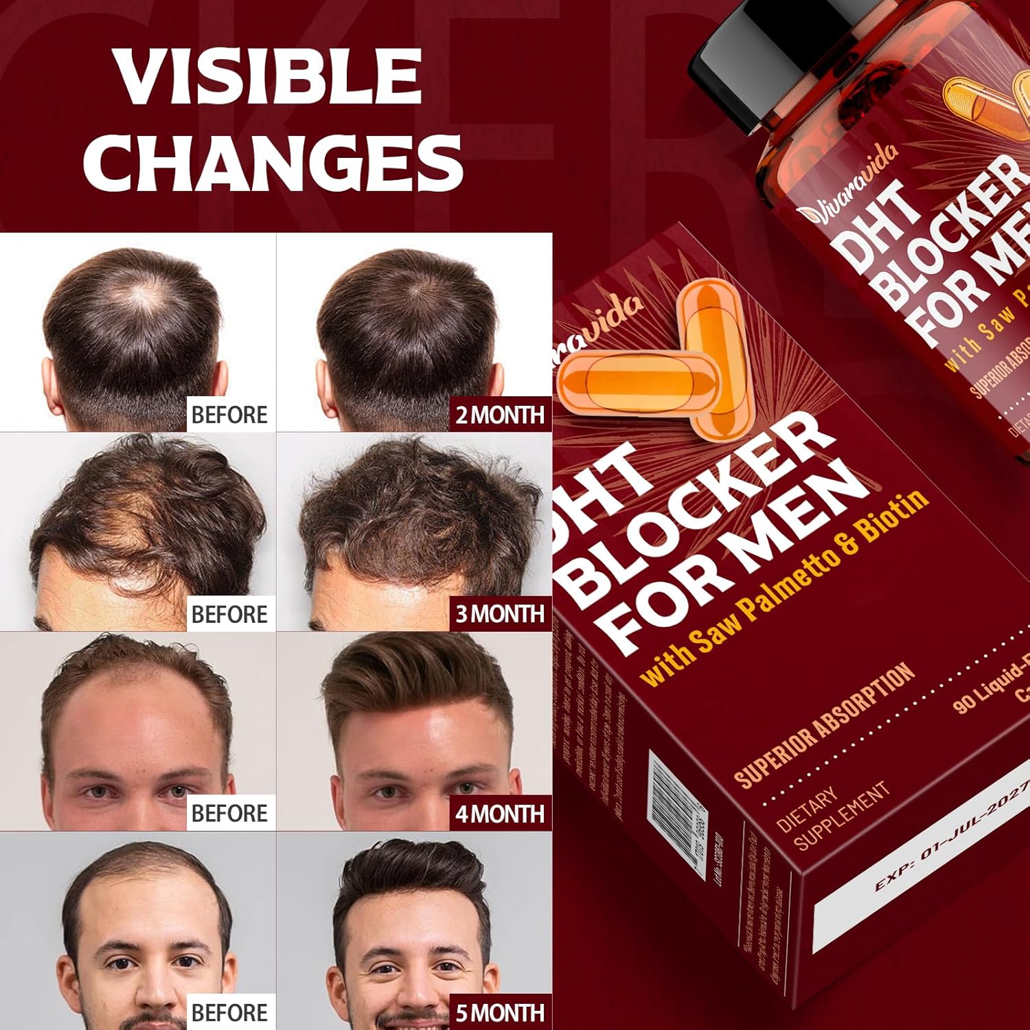 DHT Blocker for Men | Hair Growth Supplement with Saw Palmetto & Biotin - Hair Growth Vitamins - Hair Regrowth - Natural Hair Loss Supplements Liquid-Filled - Proprietary Herbal Blends (90 Capsules) - Image 6
