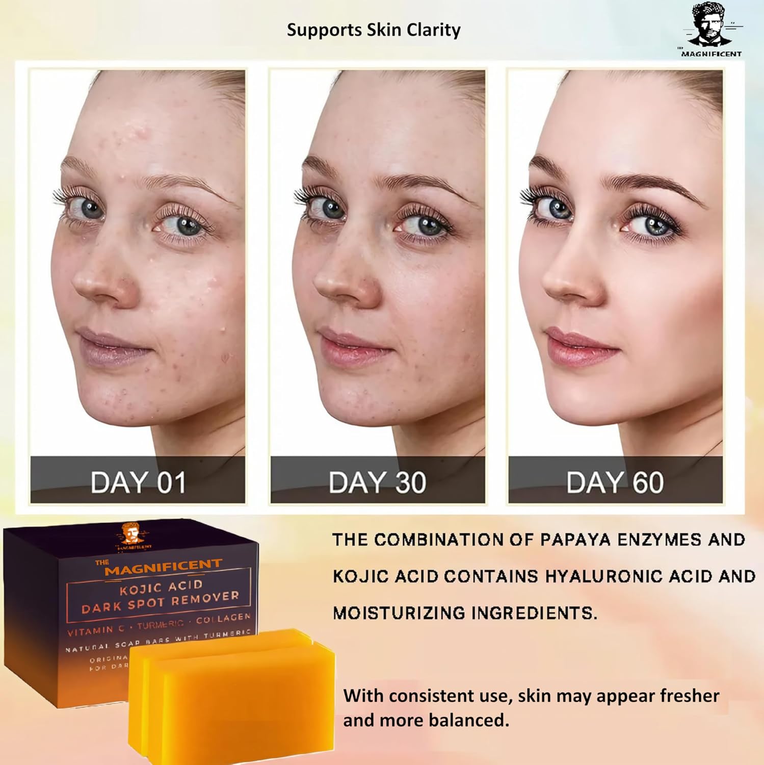 The Magnificent Kojic Acid Brightening Soap Bars – Japanese Complex with Turmeric, Hyaluronic Acid, Vitamin C, Retinol, Shea Butter & Vitamin E(2Pack+Holder) (2Pack+H) - Image 4
