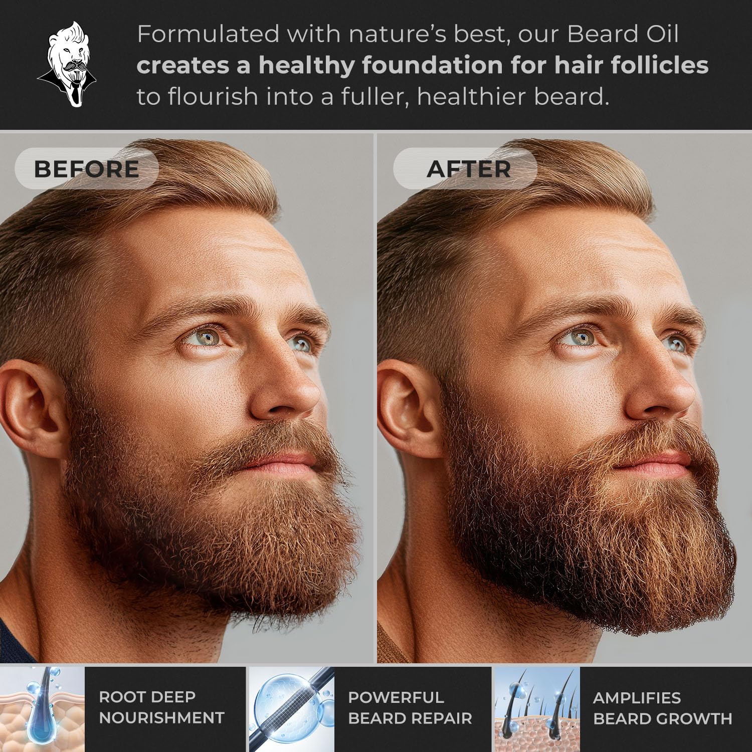 Nut-Free Hypoallergenic All Natural Beard Oil for Men - 30ml Mustache Conditioner Moisturizer - Image 4