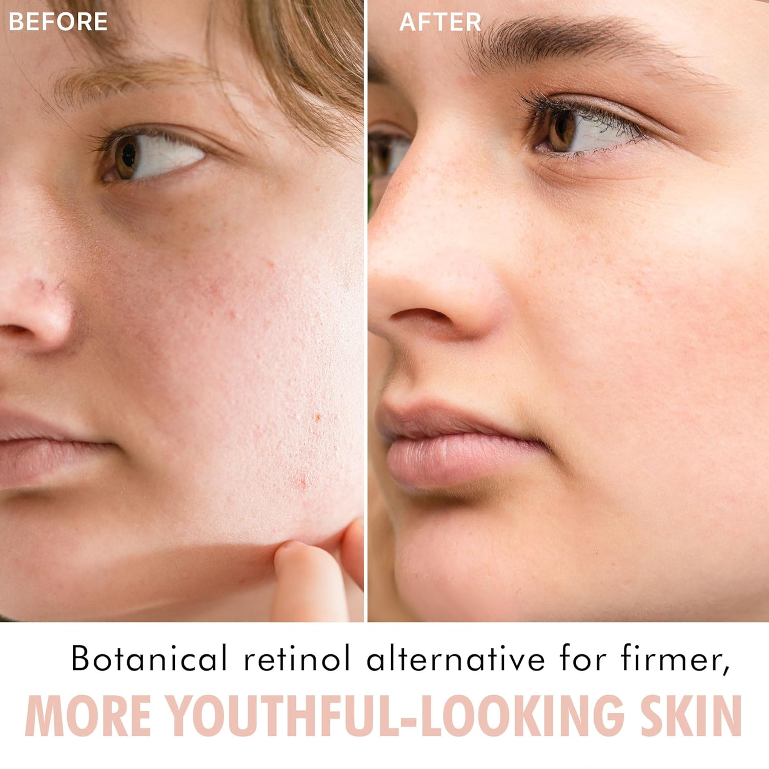Bakuchiol Anti-Aging Serum USA Made Vegan Cruelty Free Smooths Skin Reduces Fine Lines - Image 2