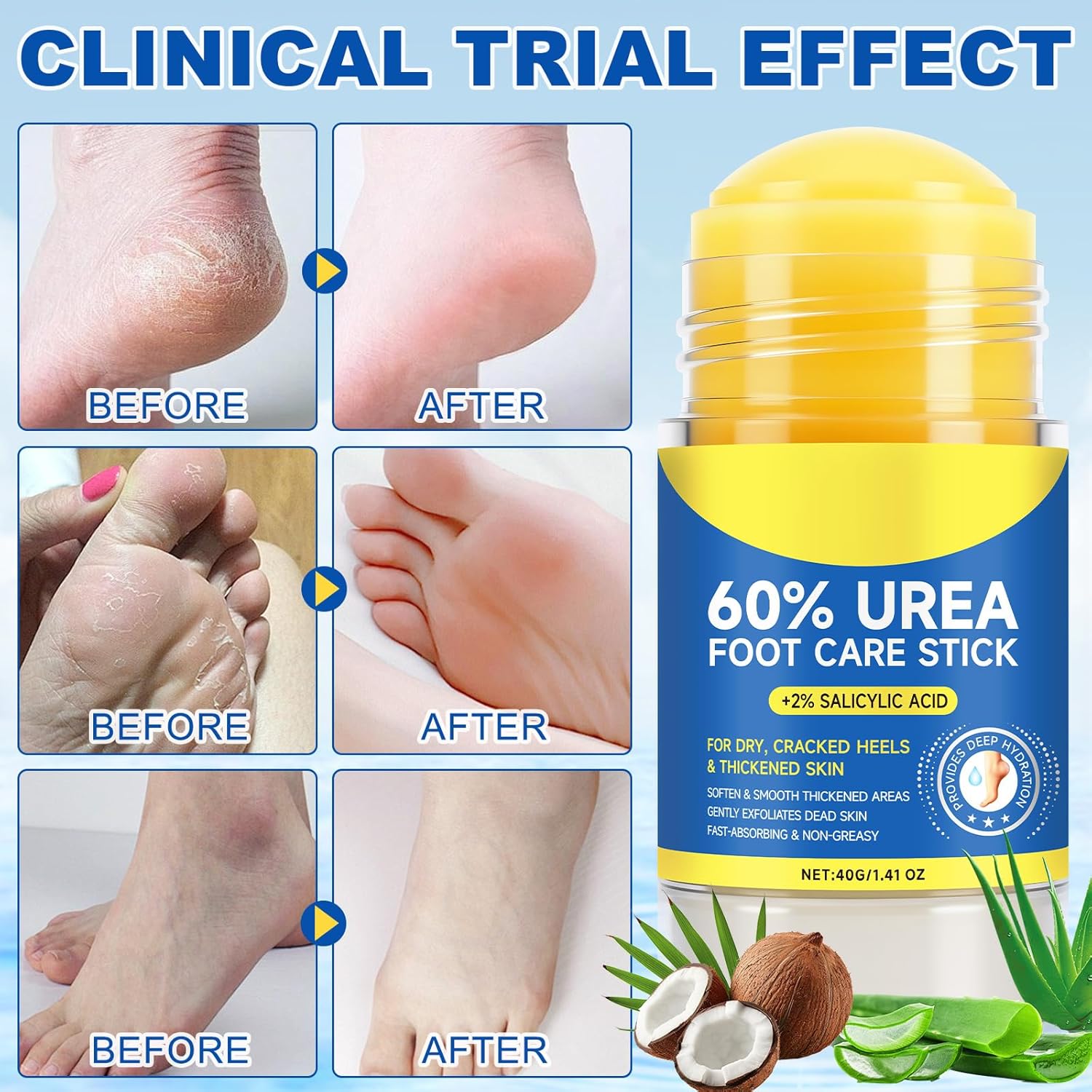 Urea Cream Stick 60% Salicylic Acid 2% for Cracked Heels and Dry Skin 1.5 oz - Image 5