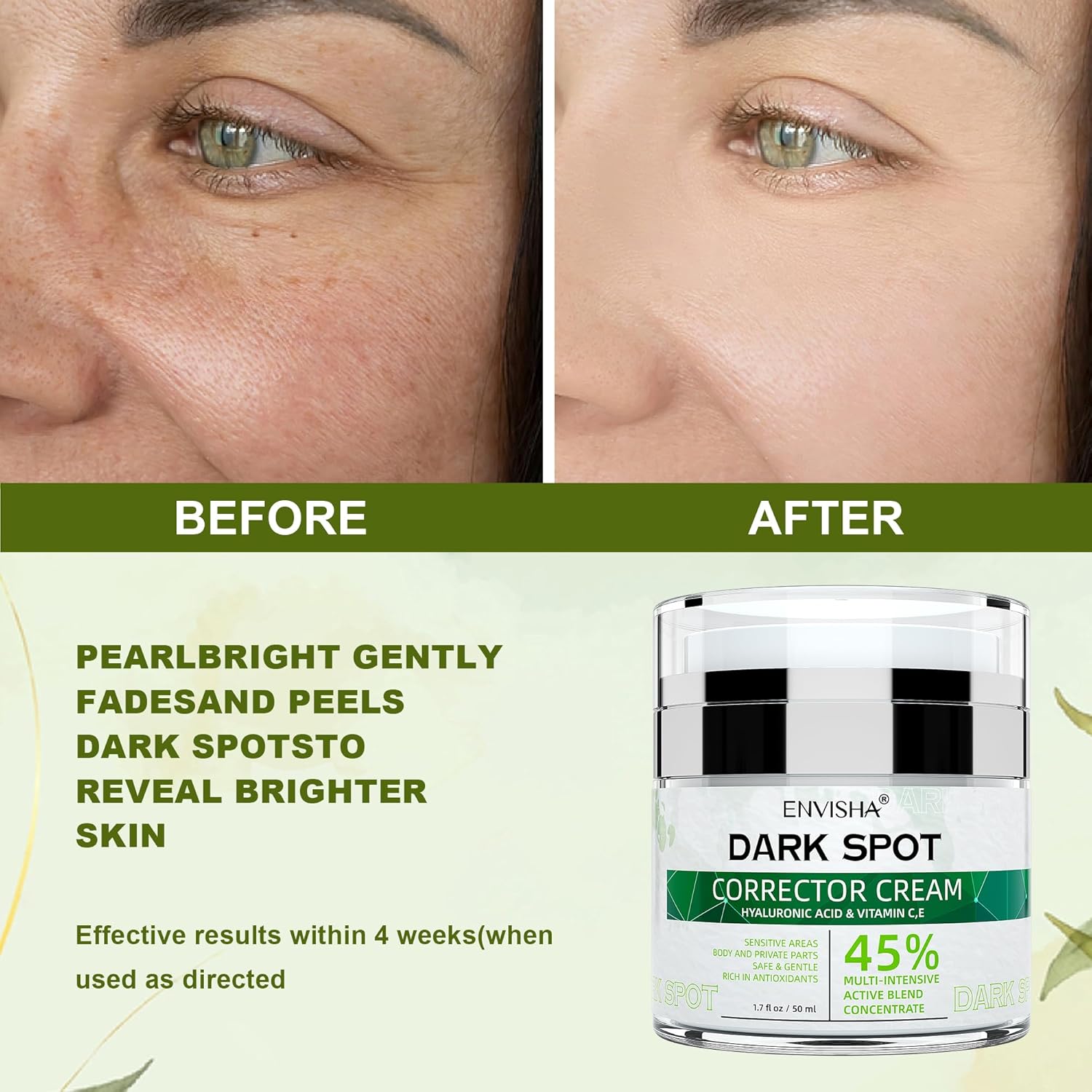 Brightening Dark Spot Remover Cream Face Body Moisturizer Sun Age Spots 2 oz - Image 4