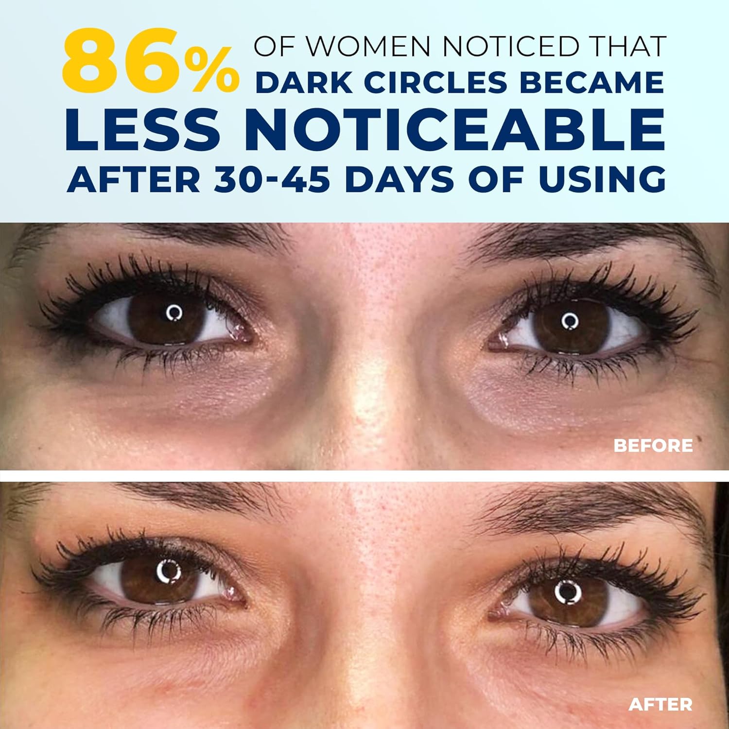 Under Eye Brightener Cream 4-in-1 for Dark Circles with Niacinamide Caffeine Retinol Peptides 0.5 oz - Image 7