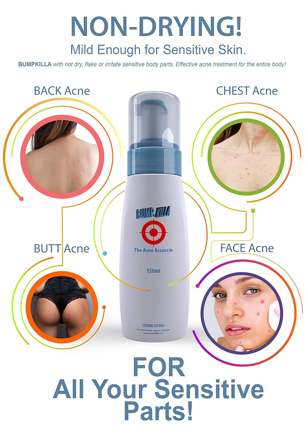 Gentle Acne Treatment Cream and Toner for Sensitive Skin 80% Reduction 4 Weeks - Image 2