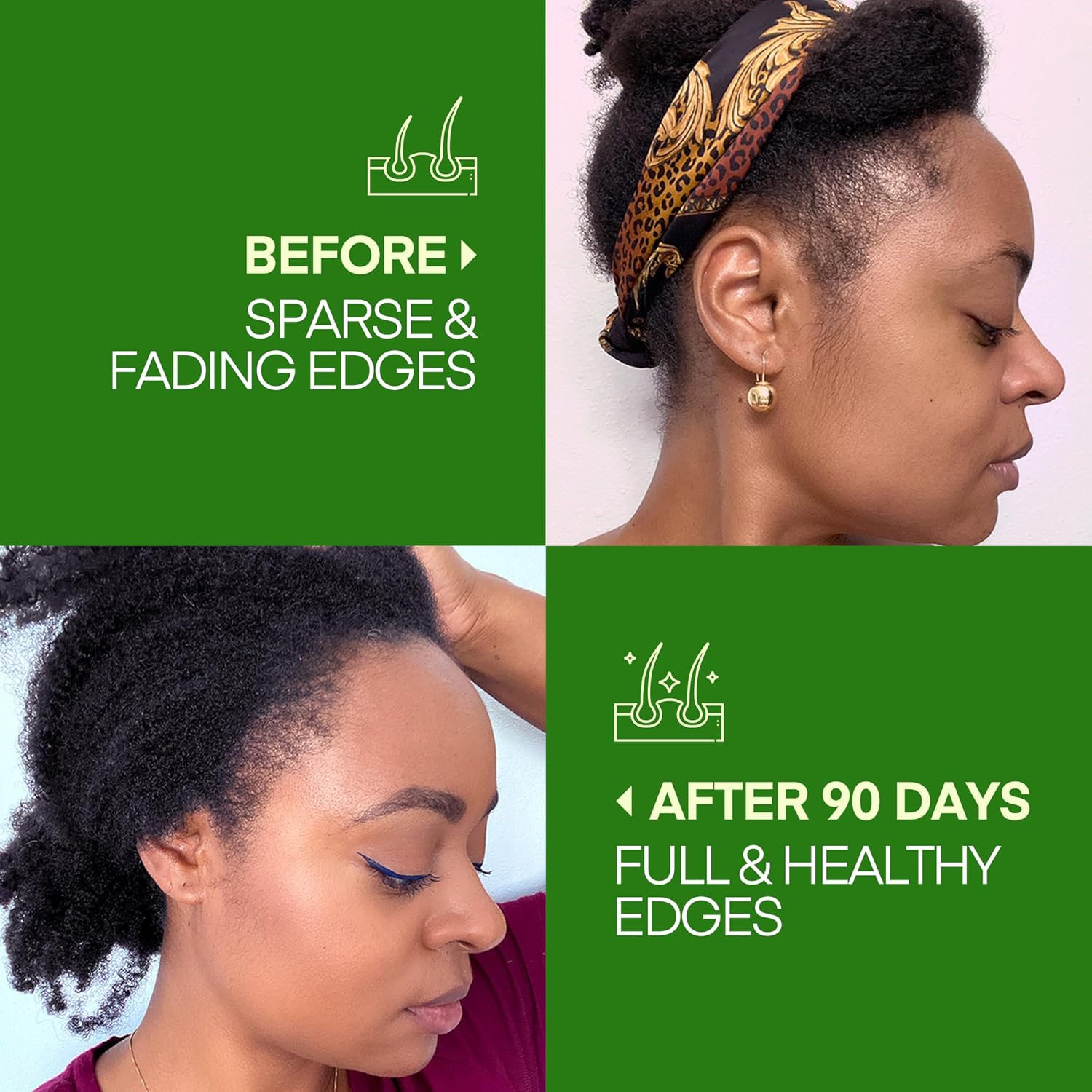 Pure Raw Batana Oil for Hair Growth 4 Fl Oz - Dr Sebi Organic & Natural Honduras Formula - Image 2