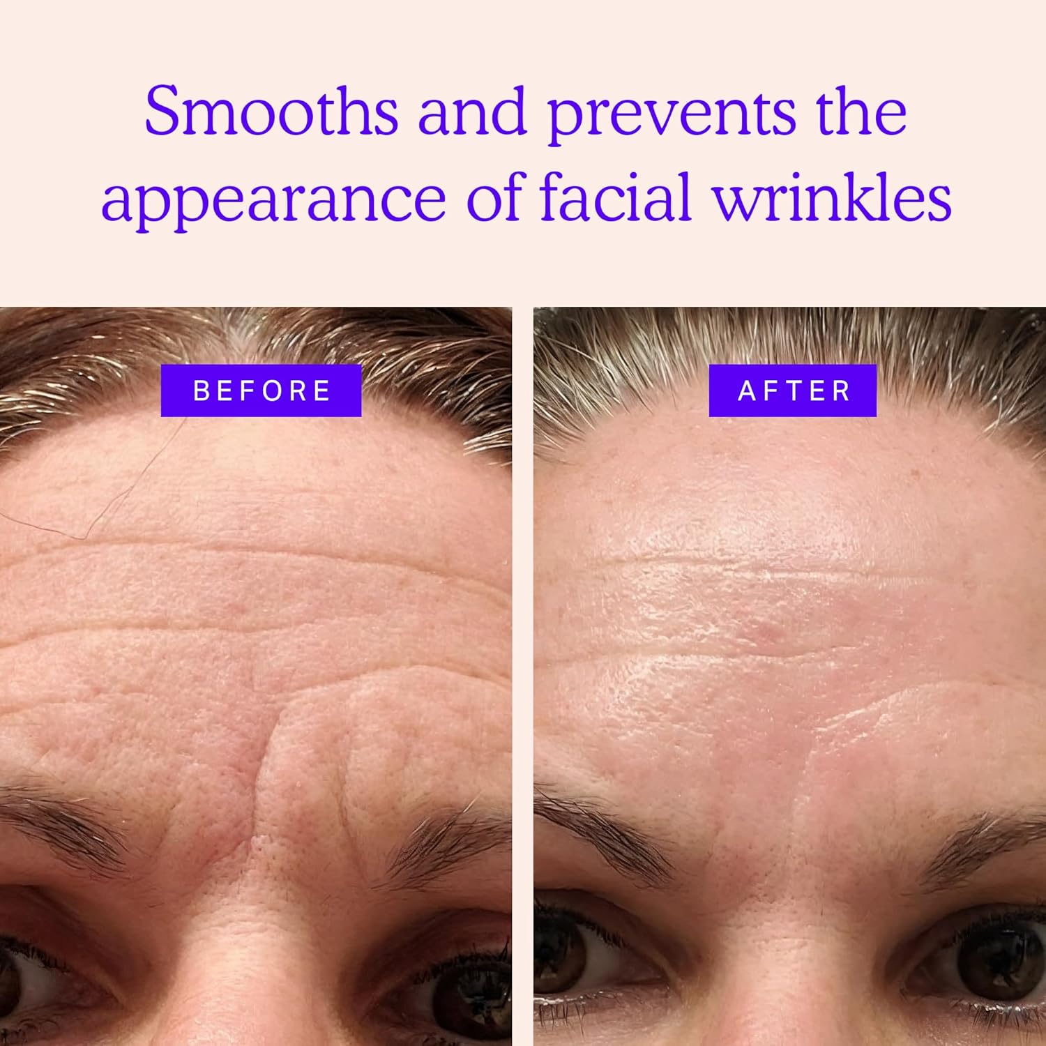 BLUMBODY 160 Count Mini Anti-Wrinkle Facial Patches for Eyes Mouth Forehead Non-Silicone - Image 2
