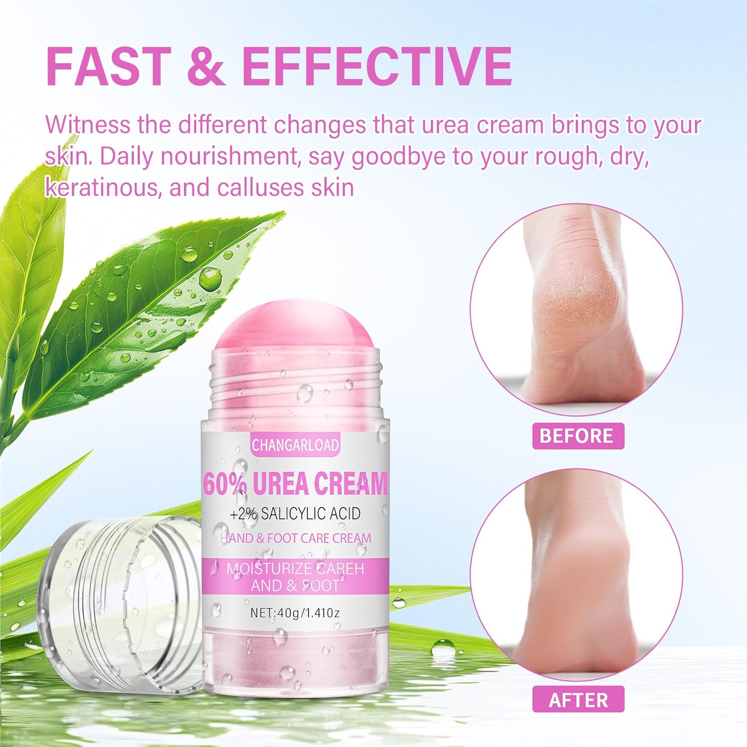 Maximum Strength Urea Foot Cream Intensive Repair Dry Cracked Skin 1.41 Oz - Image 6