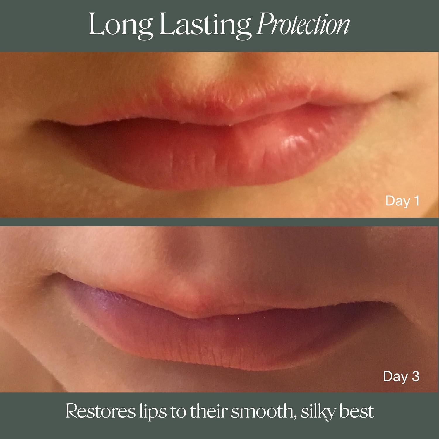 Doctor Rogers Lip Balm. Hydrating & Softening Lip Moisturizer for Very Dry Lips, Natural & Hypoallergenic, 0.15 Ounce (4.25 g) Tube - Image 6