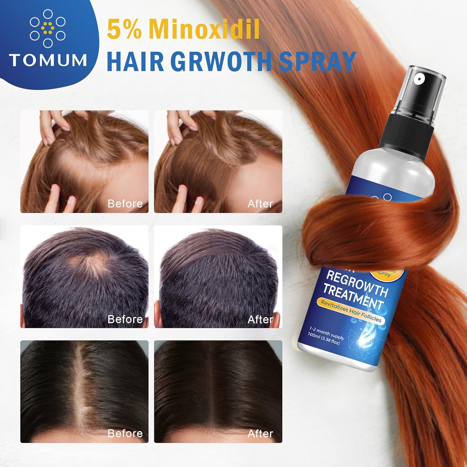 Minoxidil 5% Hair Regrowth Spray Treatment for Men and Women, 100ml Bottle - Image 6