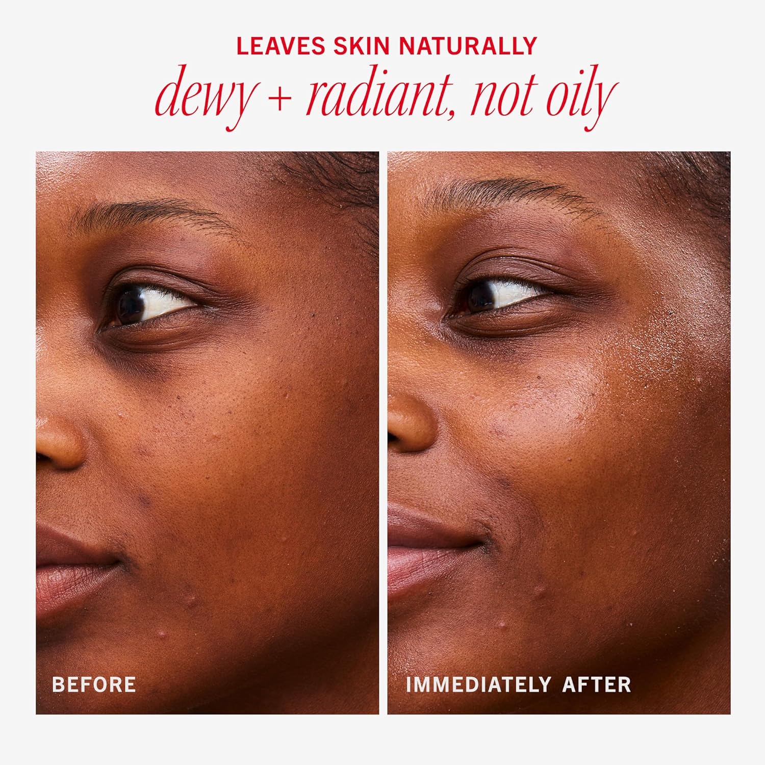 First Aid Beauty - Hydrating Dewy Gel Cream, Lightweight Oil-Free Facial Moisturizer with Hyaluronic Acid and Ceramides, Helps Reduce Excess Oil Build Up & Improve Skins Hydration, 1.7 oz - Image 6