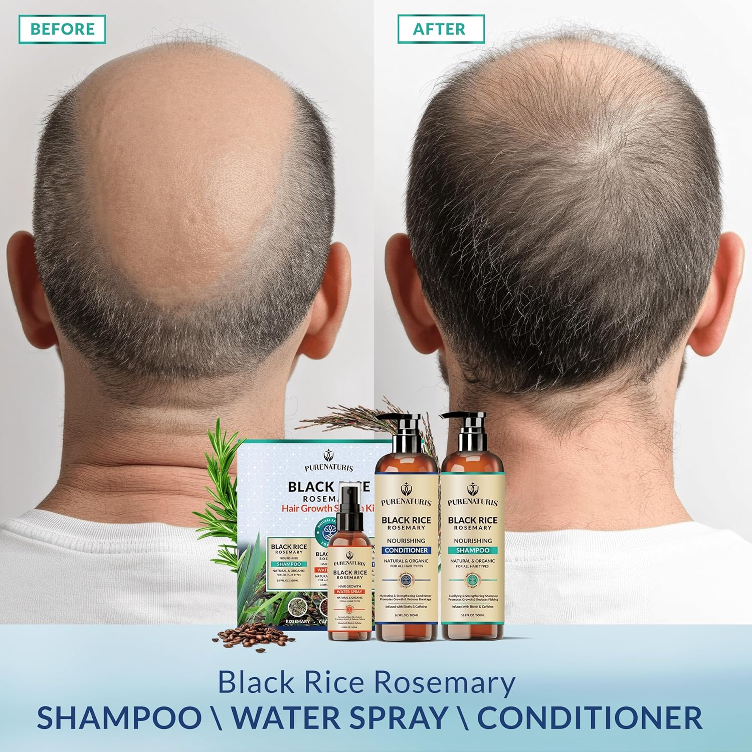 Organic Rosemary Black Rice Water Shampoo Conditioner Set for Hair Growth, Rice Water Spray, w/Rosemary Water, Biotin, Caffeine, Routine Shampoo for Women Men Hair Loss Thickening, Longer - Image 6