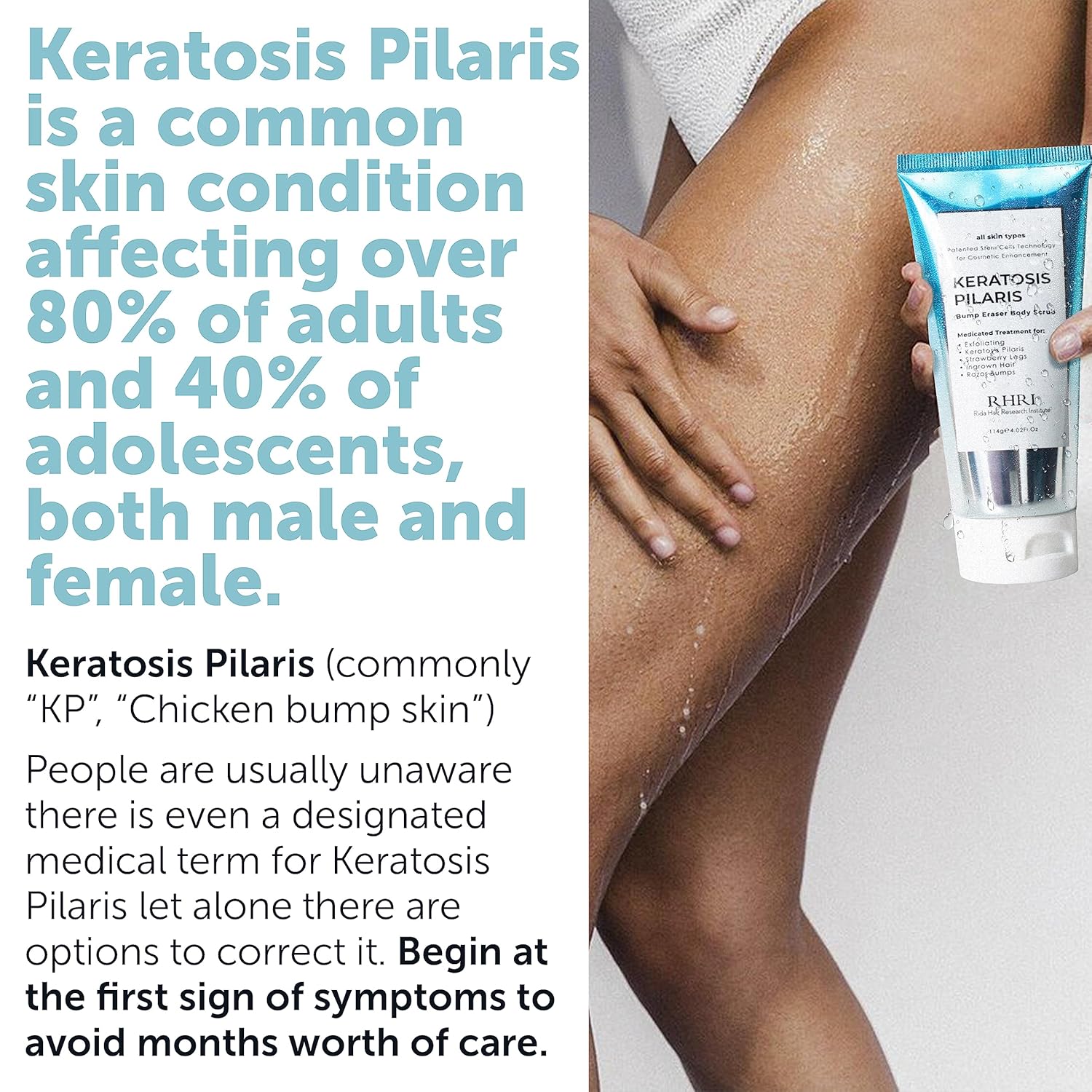 KP Bump Eraser Exfoliating Body Scrub for Keratosis Pilaris Smooth Skin 8 oz - Image 3