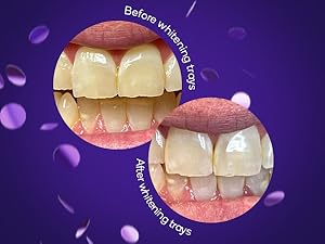 BURST whitening