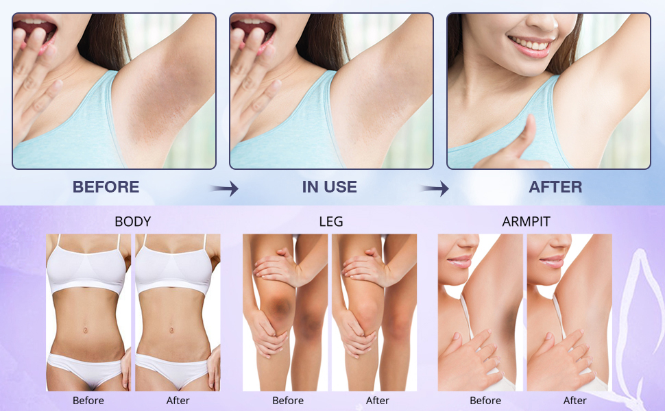 dark armpit remover