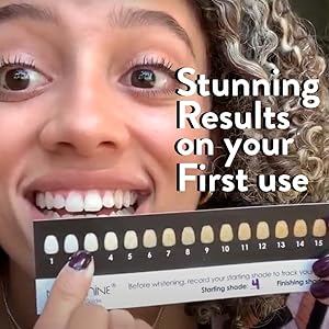 Teeth Whitening Kit Inside Photos