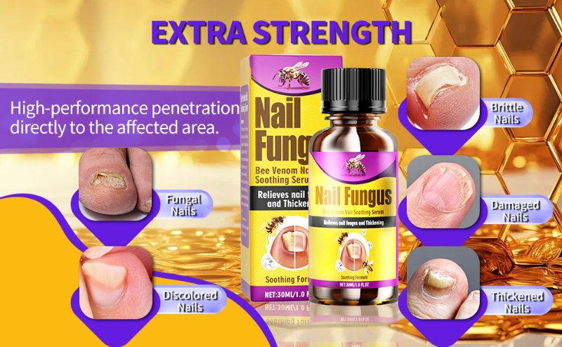 Toenail Fungus Treatment