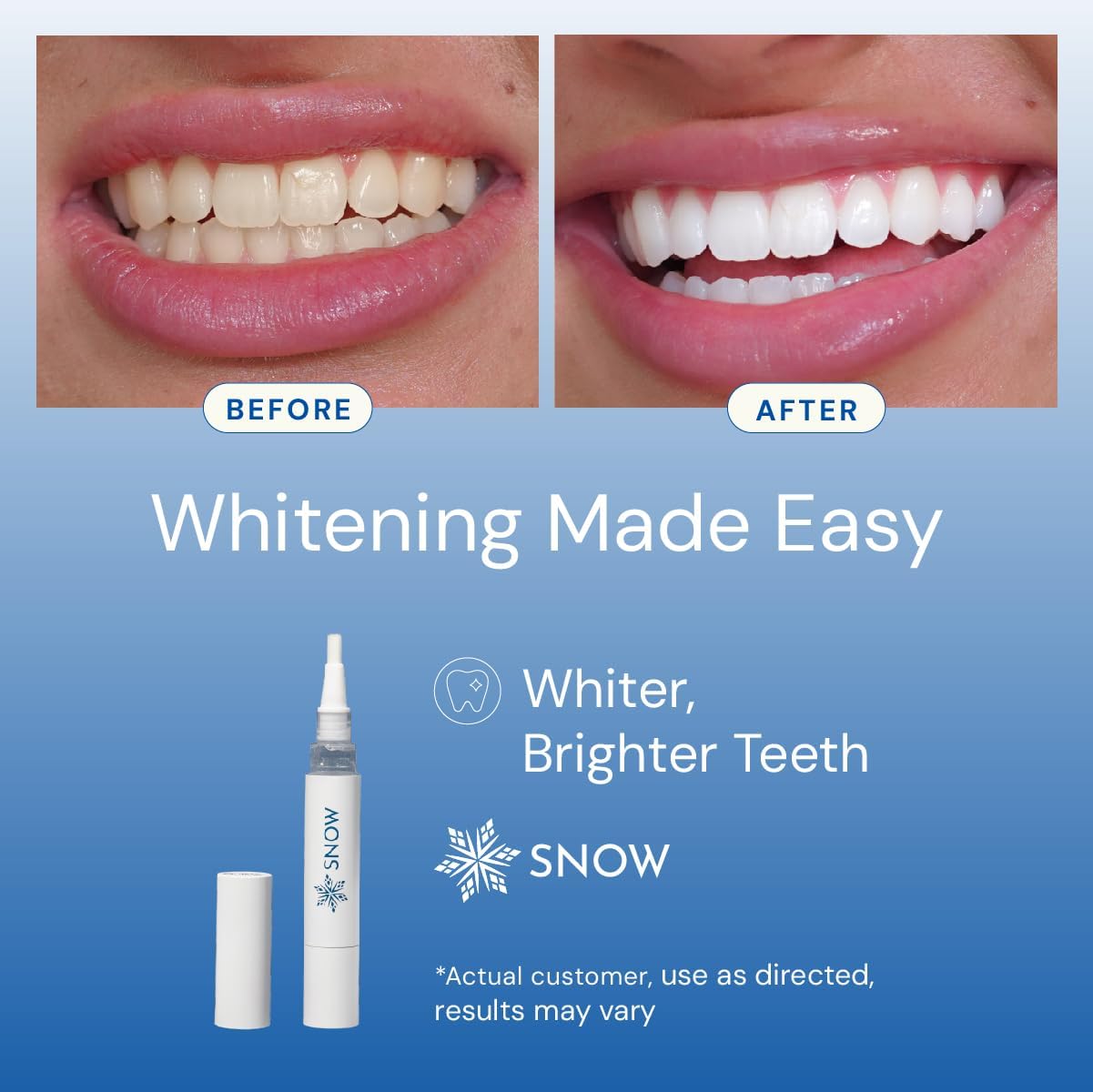 SNOW DiamondSeries Wand for Teeth Strengthening and Enamel Repair - 2 ml Travel Size - Image 4