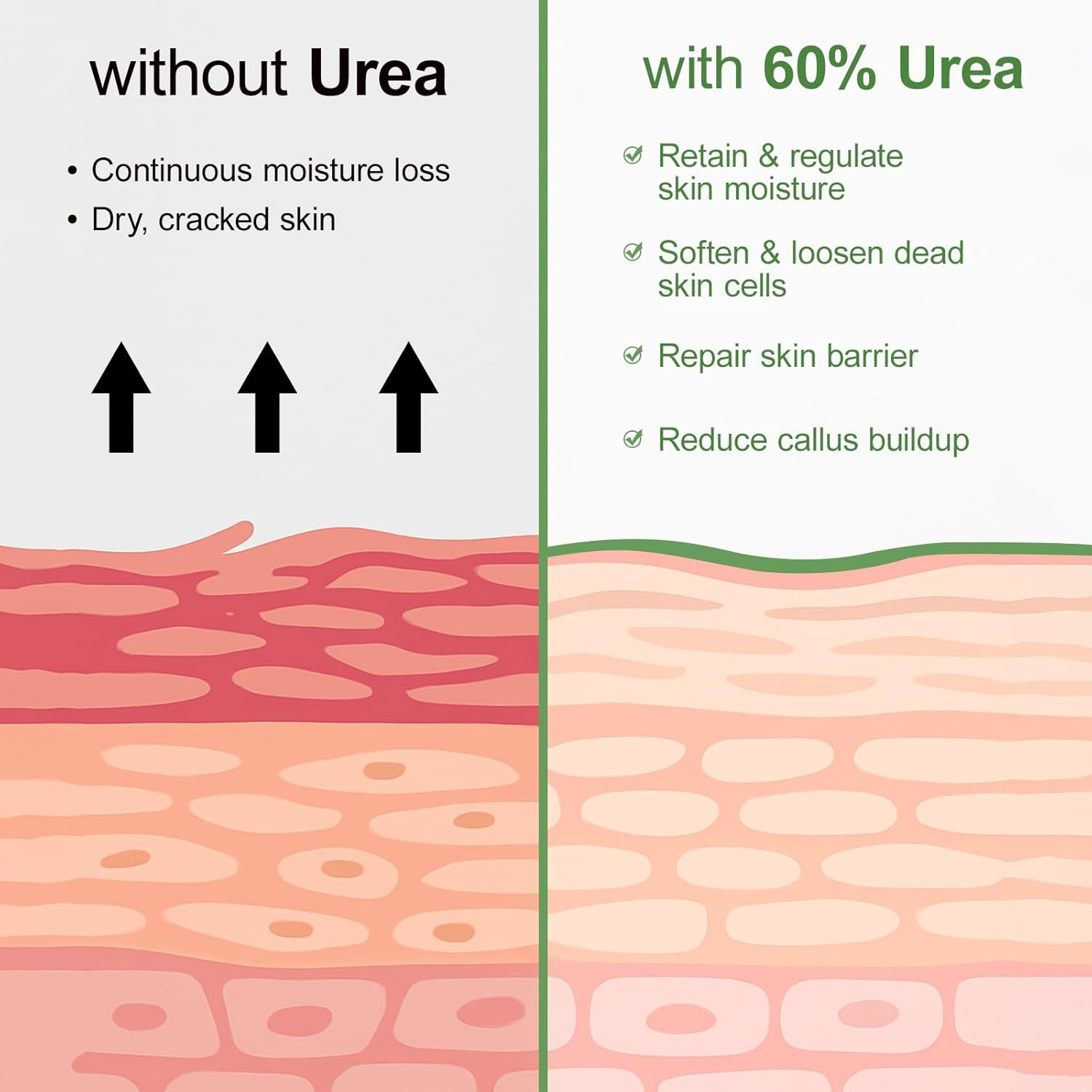 Urea Cream 60 Percent For Feet Maximum Strength Plus Salicylic Acid 2%, Tea Tree Foot Lotion For Dry Feetcracked Heels Treatment Athletes Foot Cream Intensive Repair Foot Moisturizer Care 5.29oz - Image 6