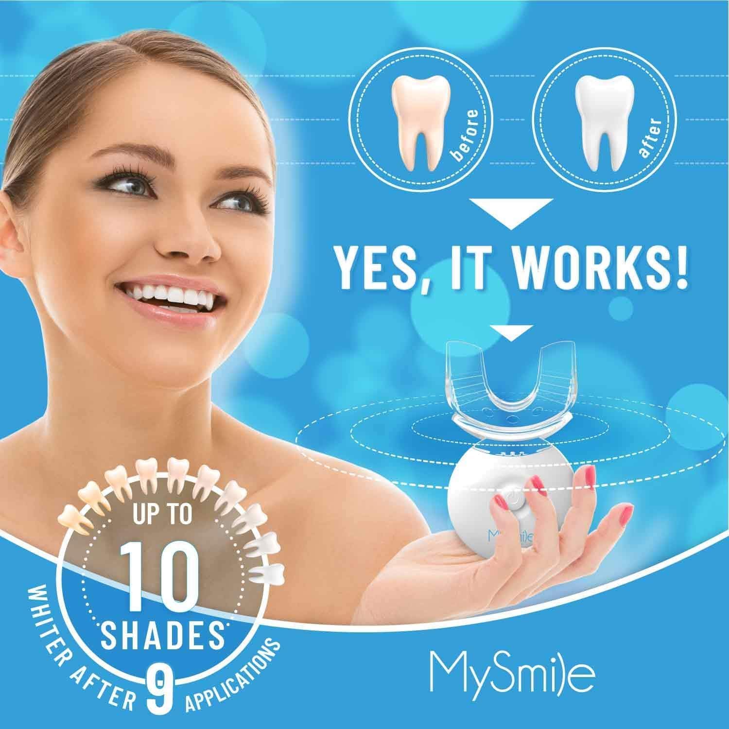 MySmile Advanced Teeth Whitening Kit with LED Accelerator, 10-Minute Daily Treatment - Image 3
