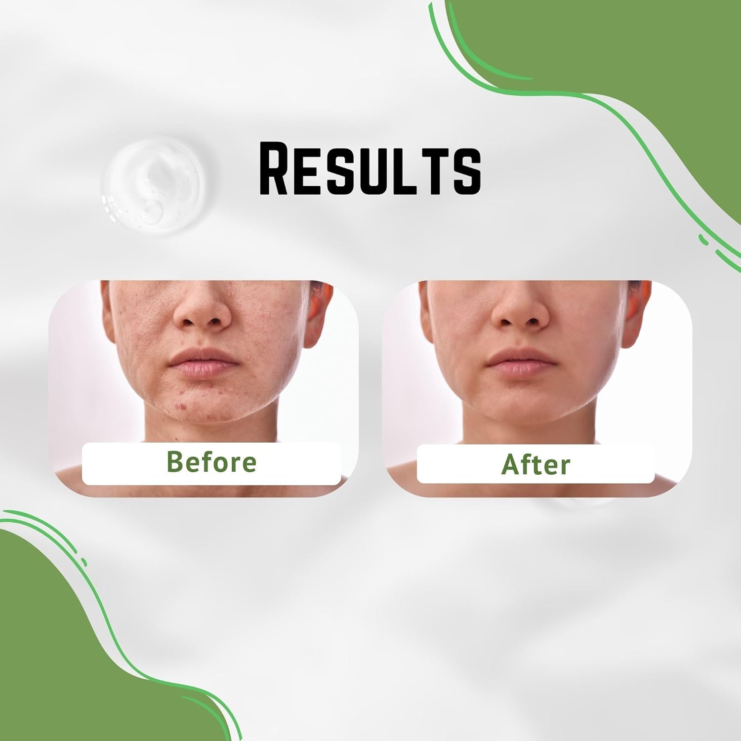 Soothing Aloe Vera Face and Body Cream for Dark Blemishes and Scars 4 oz - Image 7