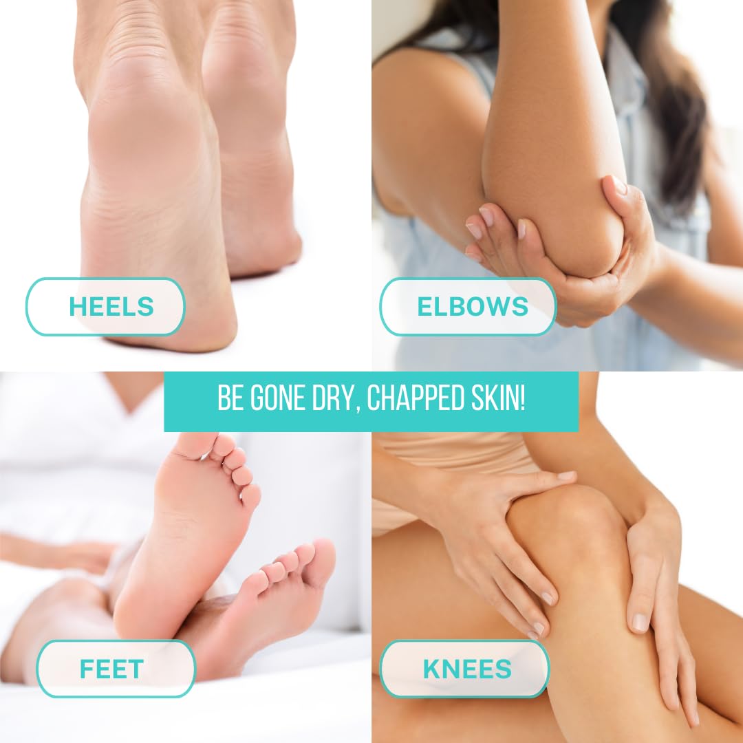 Onyx Professional Cracked Heel Repair Balm Stick(2 Pack)Dry Cracked Feet Treatment,Moisturizing Heel Balm Rolls On So No Mess Like Foot Cream or Foot Lotion, Rescues Cracked Feet,Tea Tree Scent Clear - Image 7