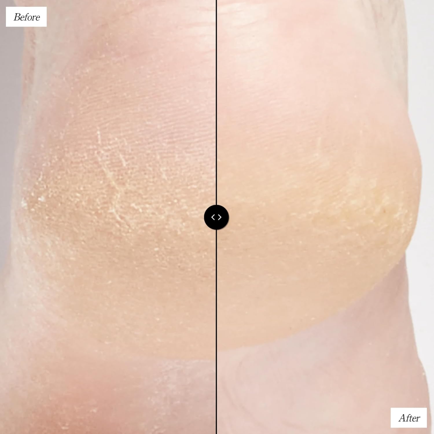 Beekman 1802 Sunshine Body Scrub - Fragrance Free - 8 oz - 7.5% PHA Body Exfoliator - Diminishes Look of Bumps Associated with Keratosis Pilaris - With Pumice - Good for Sensitive Skin - Cruelty Free - Image 4