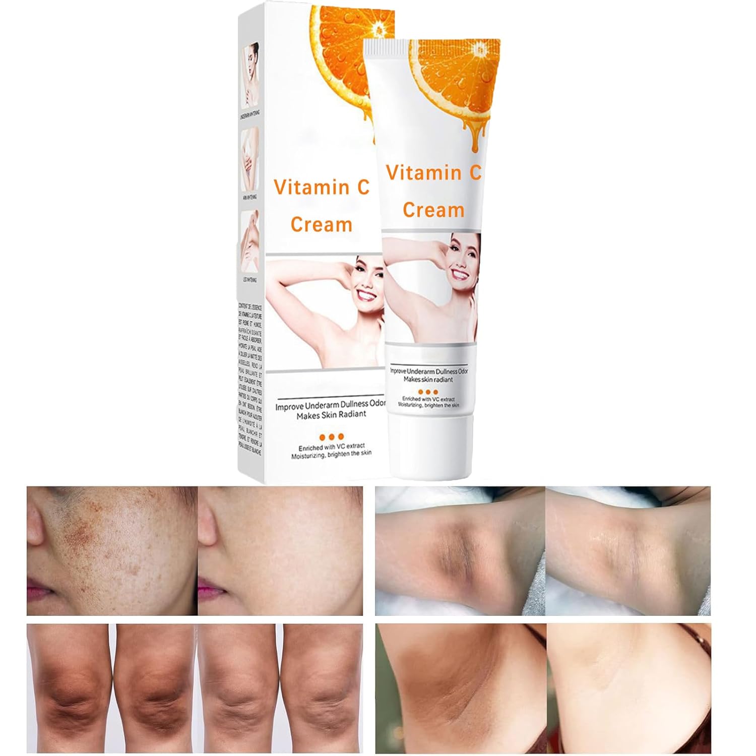 Dark Spot Remover for Intimate Area and Inner Thighs, Vitamin C Skin Cream, Dark Spot Corrector for Body, Armpit, Underarm, Knees, Elbow, Neck, Private Areas and Bikini Line, 1.77Oz (1 PCS)