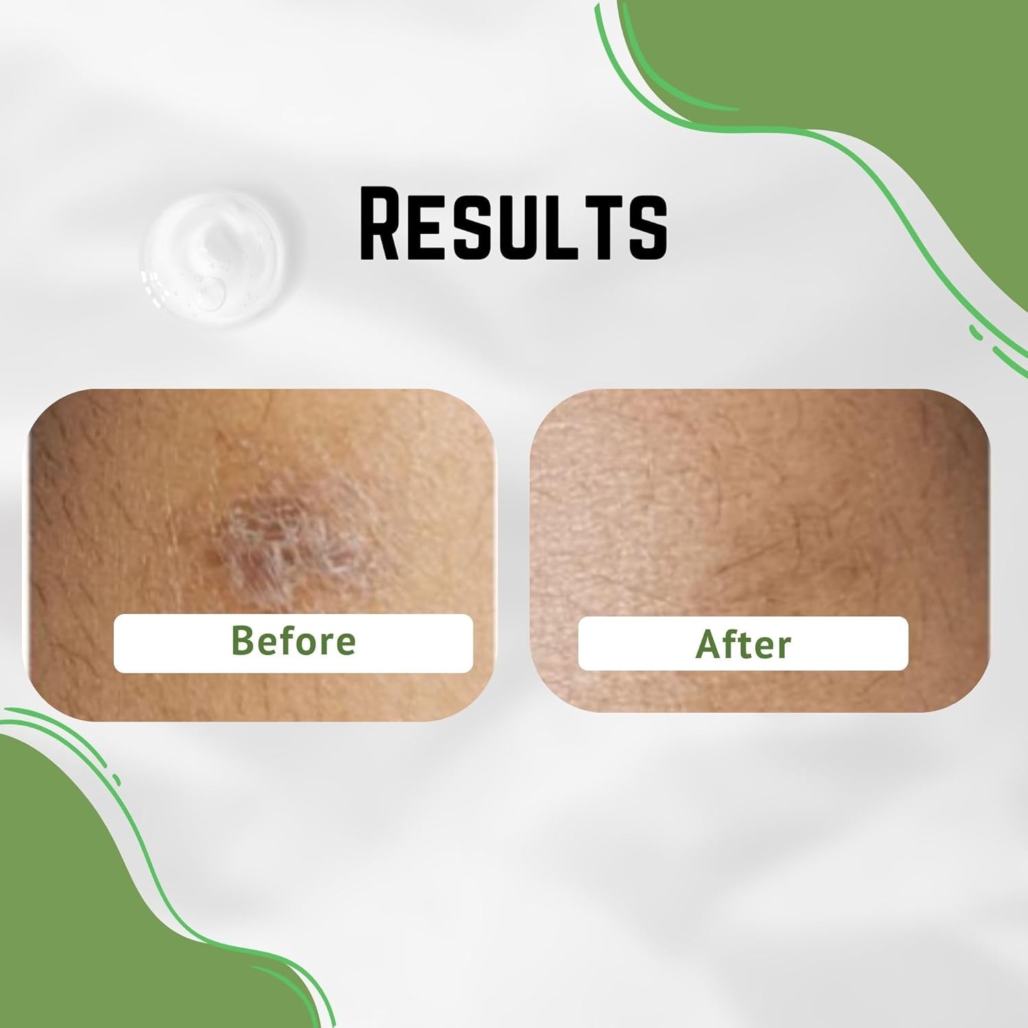 Soothing Aloe Vera Face and Body Cream for Dark Blemishes and Scars 4 oz - Image 8