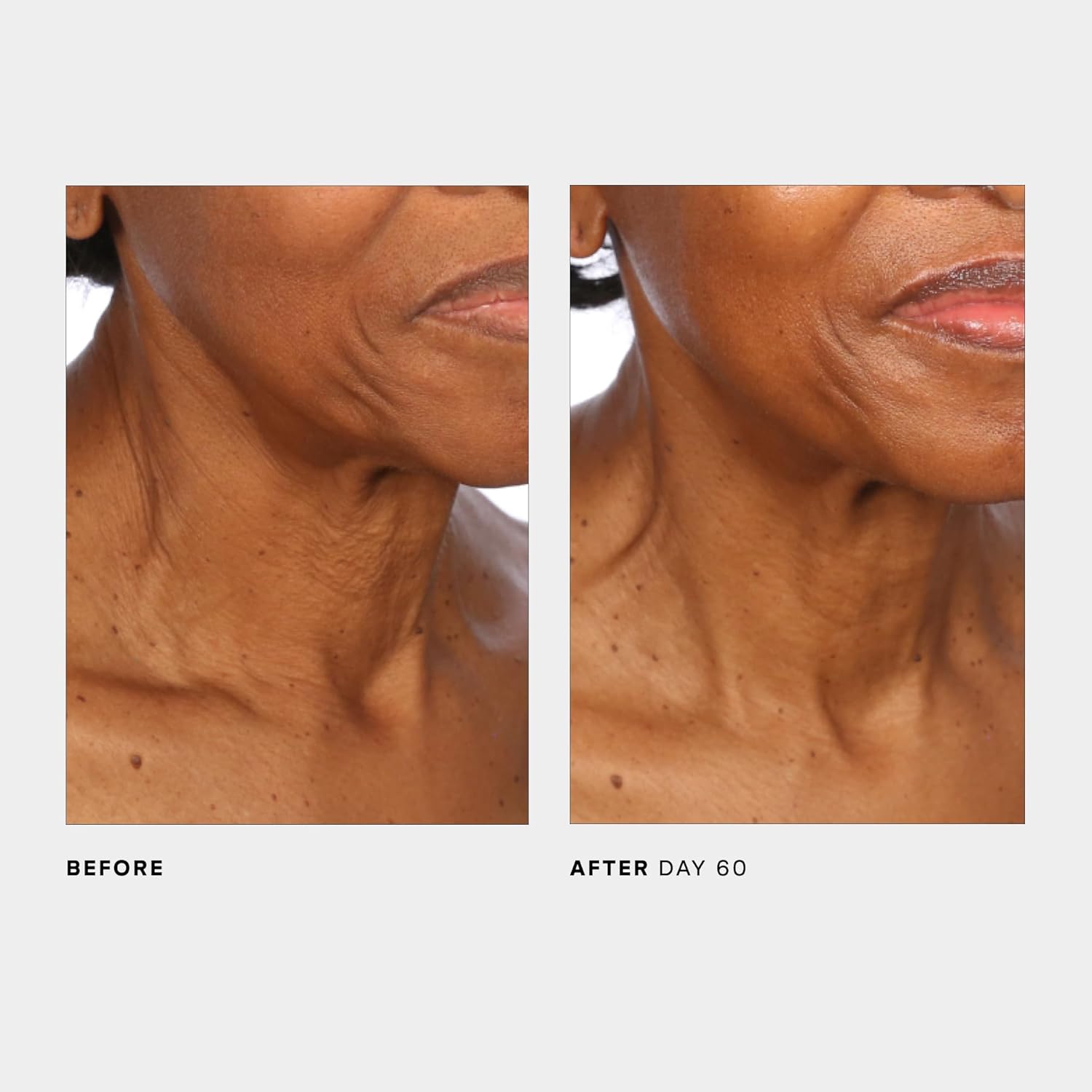 U Beauty The SCULPT Neck + Décolleté Concentrate - Image 8
