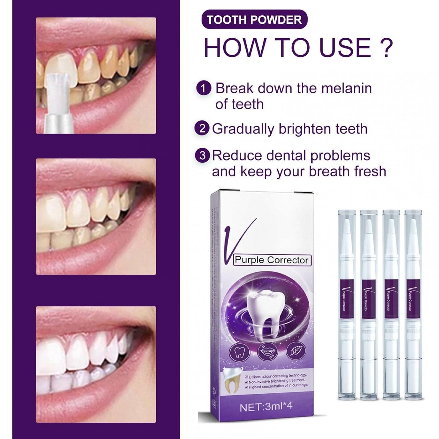 Teeth Whitening Pen, Teeth Stain Remover to Whiten Teeth, Effective&Painless, No Sensitivity, Travel-Friendly, Easy to Use, Beautiful White Smile, Oral Care, 1PC/4PCS - Image 5