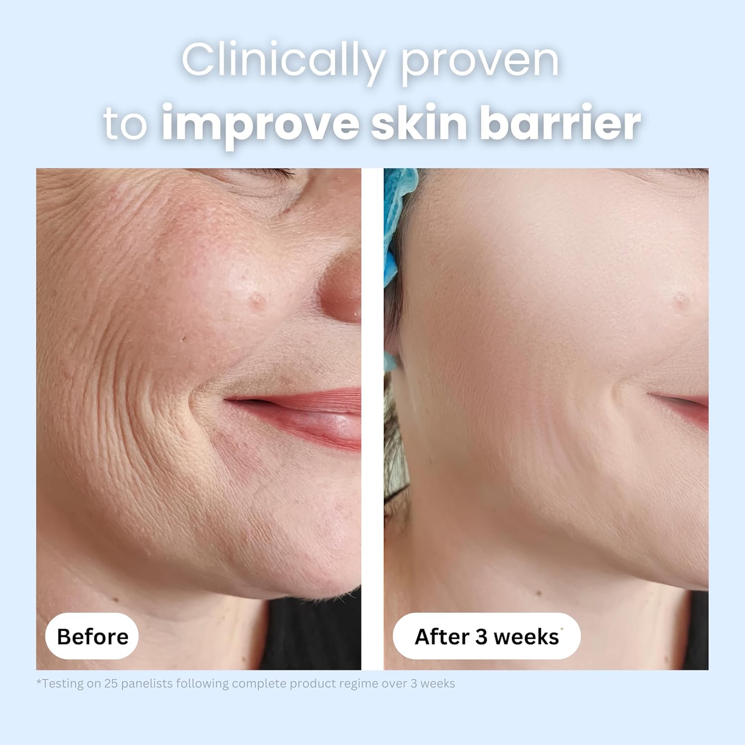 Organic Bee Venom + Manuka Day Barrier Face Moisturizer | Hydrating, Anti-Wrinkle, Collagen Booster | 2.5 month supply, 2oz/60ml | Made in New Zealand - Image 4