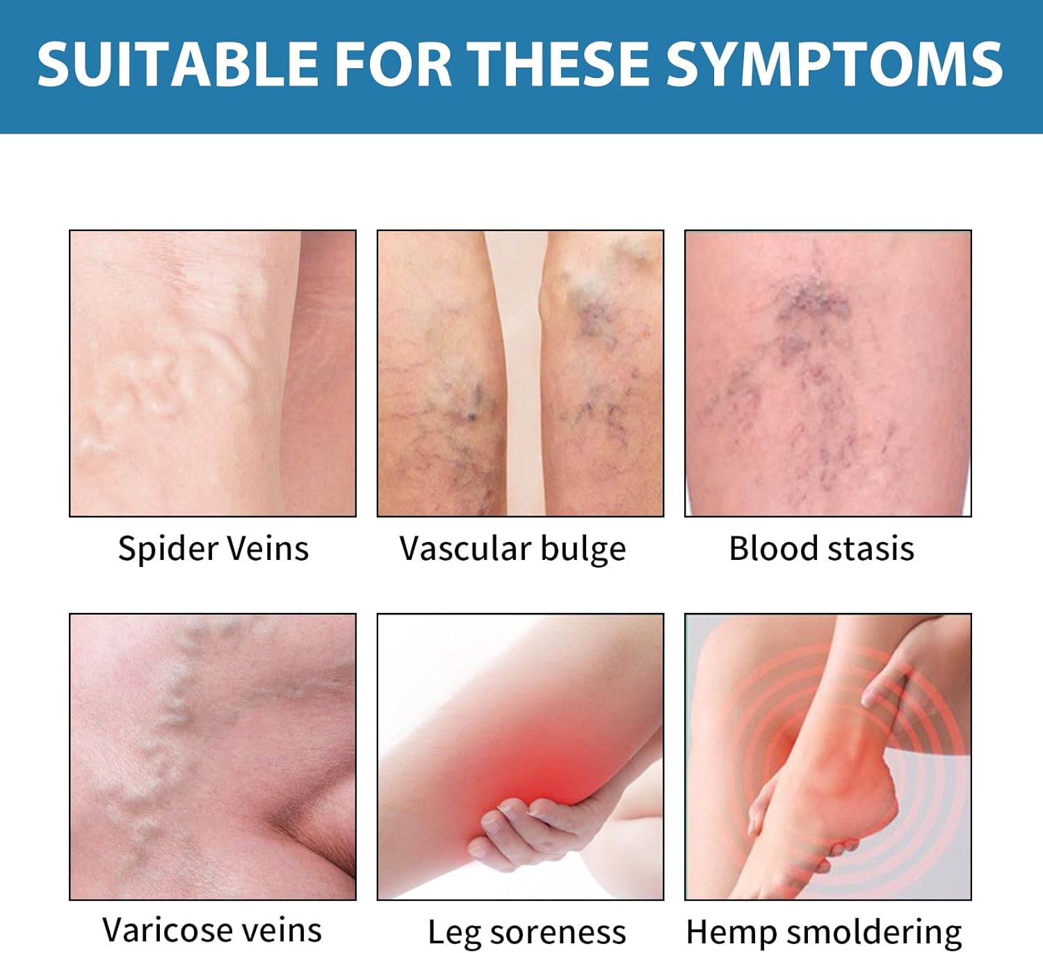Herbal Varicose and Spider Veins Treatment Cream for Legs, 0.7 Oz - Image 2