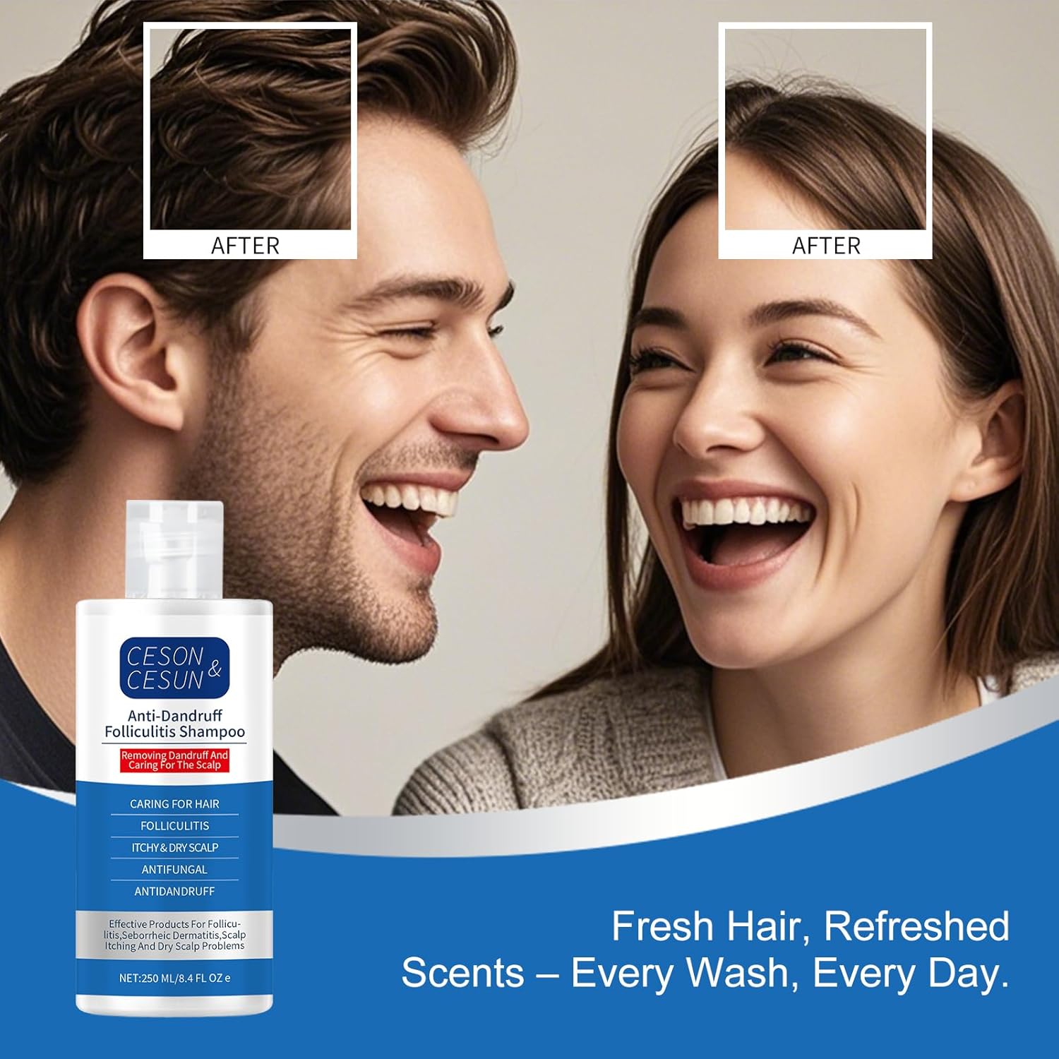 Ceson&Cesun Anti-Fungal/Anti Dandruff 2 in 1 Shampoo for Folliculitis, Scalp Psoriasis & Seborrheic Dermatitis, Itchy & Dry Scalp Relief, Nourishes, Hydrates, Control Oil, Safe For Color-Treated Hair - Image 10