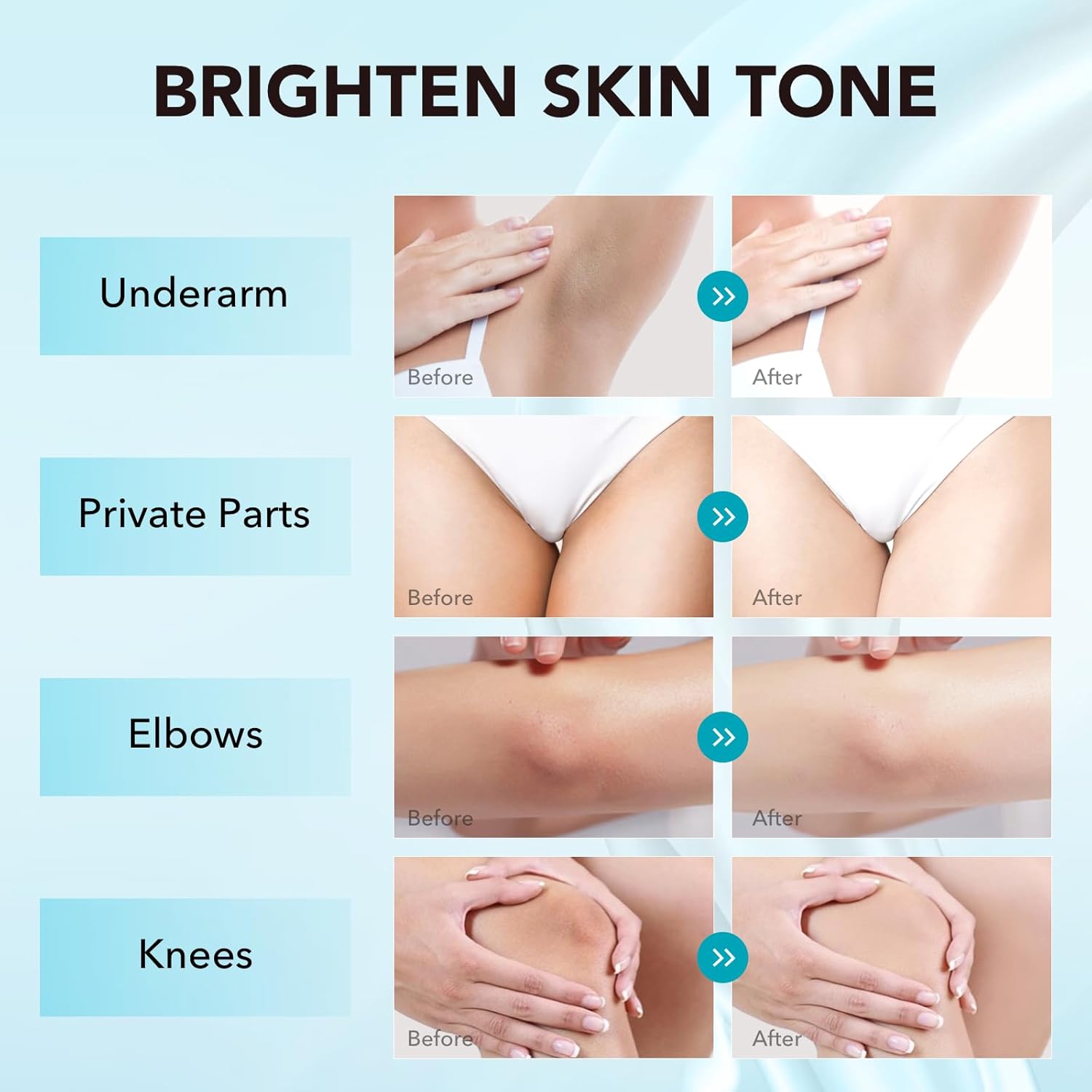 Skin Lightening Cream, Dark Spot Remover for Face Body Bleaching Cream for Intimate Areas & Body, Vitamin C Whitening for Underarms, Knees, Elbows, Inner Thighs, Bikini Line (1.7 Fl Oz) - Image 2