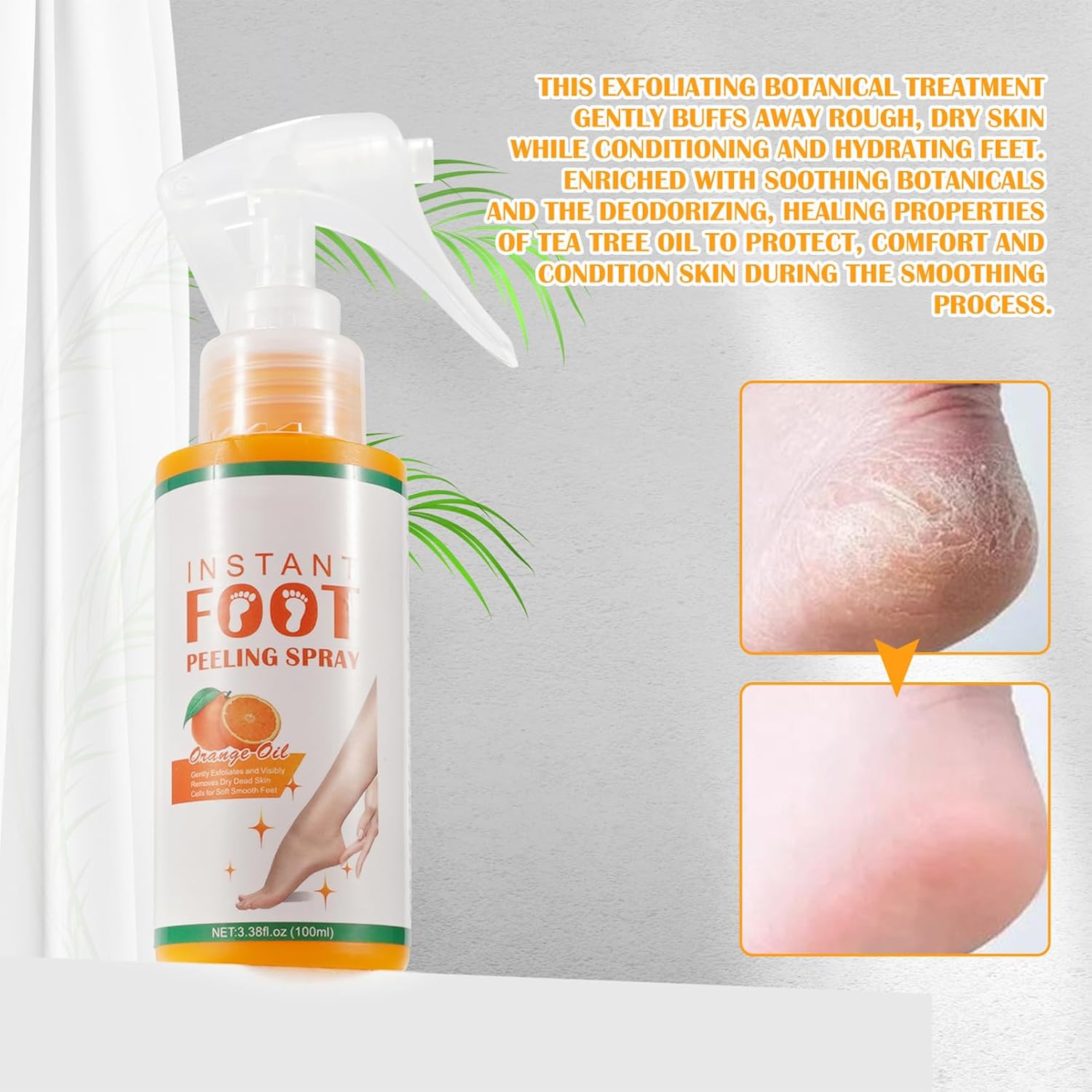 200ml Foot Peeling Spray Oil for Dead Skin Removal and Callus Treatment with Exfoliating Mask - Image 2