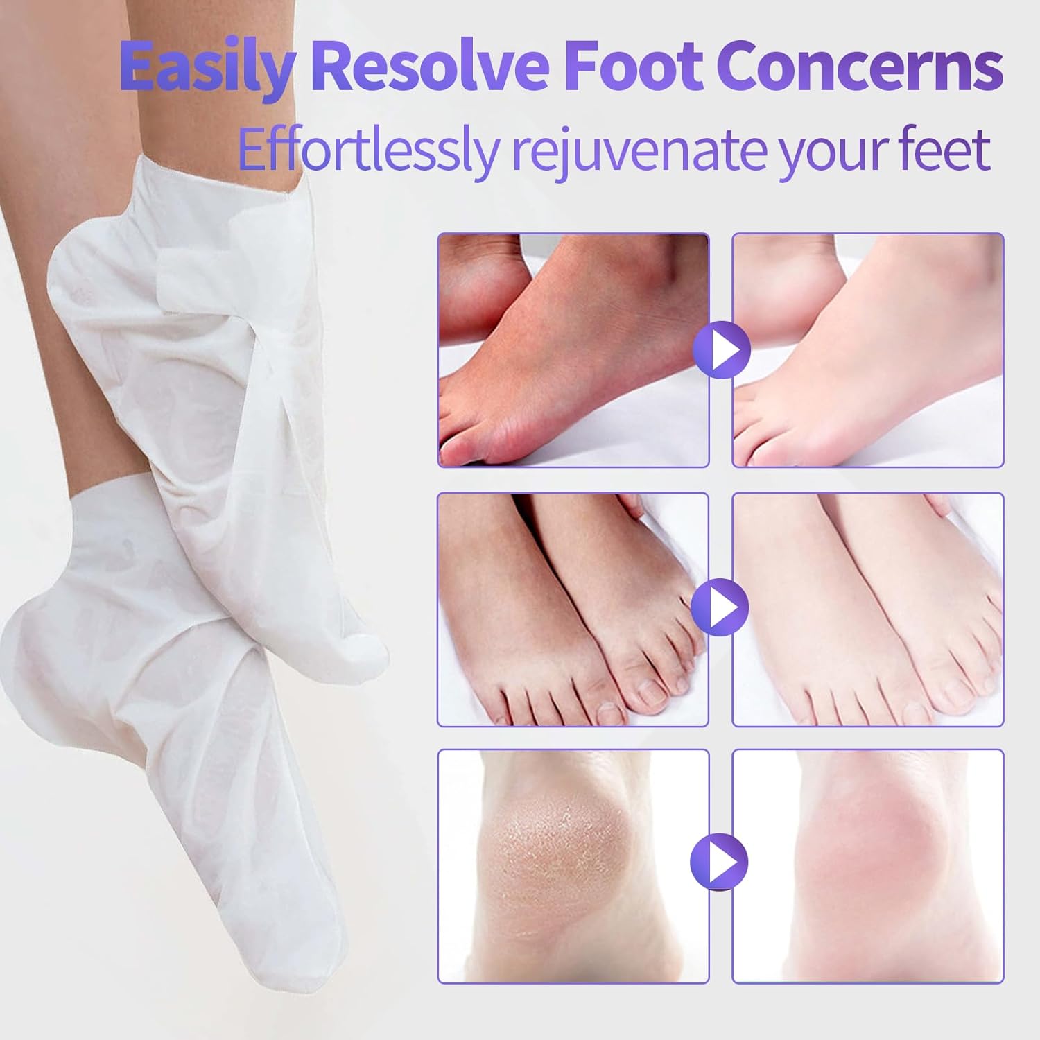 Moisturizing Foot Mask 5 Pack,Hydrating Foot Masks for Dry Cracked Feet,Moisturizing Socks Dry Skin Moisturizer for Soft and Smooth Touch Feet,Foot Care Spa Gifts for Women Men Mother's Day Gifts - Image 3