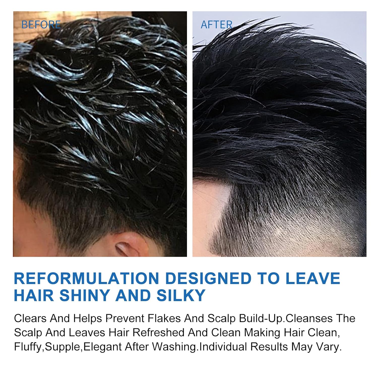 Ceson&Cesun Anti-Fungal/Anti Dandruff 2 in 1 Shampoo for Folliculitis, Scalp Psoriasis & Seborrheic Dermatitis, Itchy & Dry Scalp Relief, Nourishes, Hydrates, Control Oil, Safe For Color-Treated Hair - Image 5